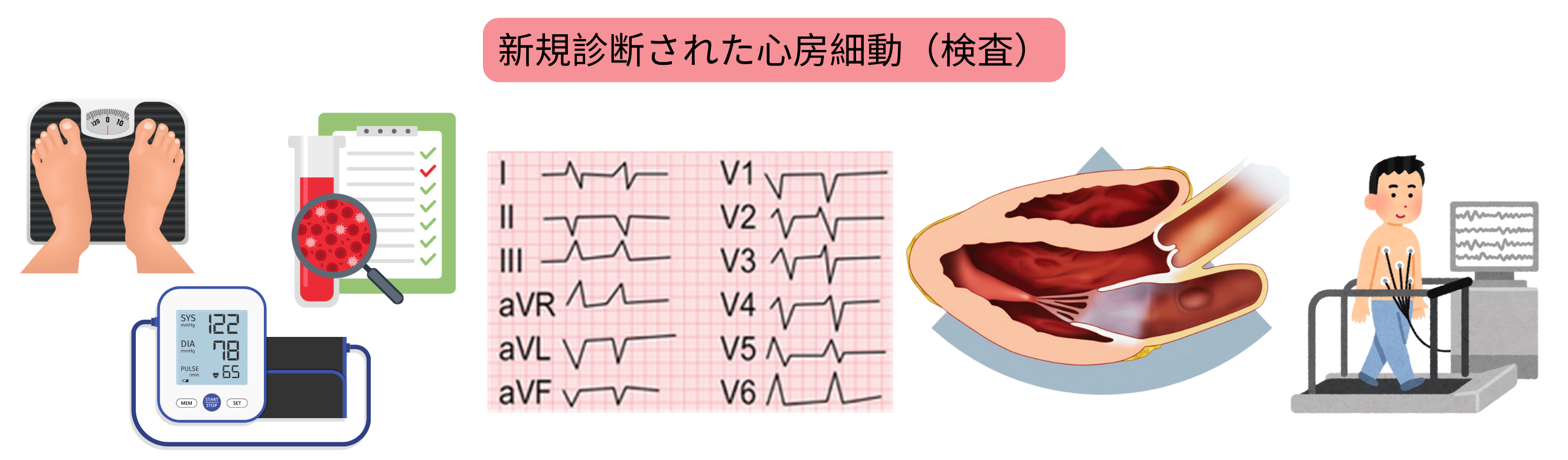 新規診断された心房細動における基本的検査として、心電図、検査室検査、心エコー検査、運動負荷試験を示すインフォグラフィック。