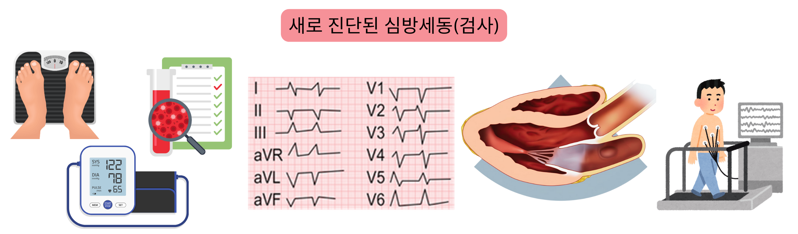 새롭게 진단된 심방세동에서 심전도, 혈액검사, 심장초음파 및 운동부하 검사를 포함한 기본 평가를 보여주는 인포그래픽.