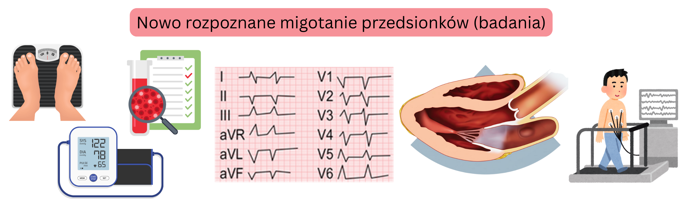 Infografika przedstawiająca podstawowe badania w nowo rozpoznanym migotaniu przedsionków, w tym EKG, badania laboratoryjne, echokardiografię i próbę wysiłkową.