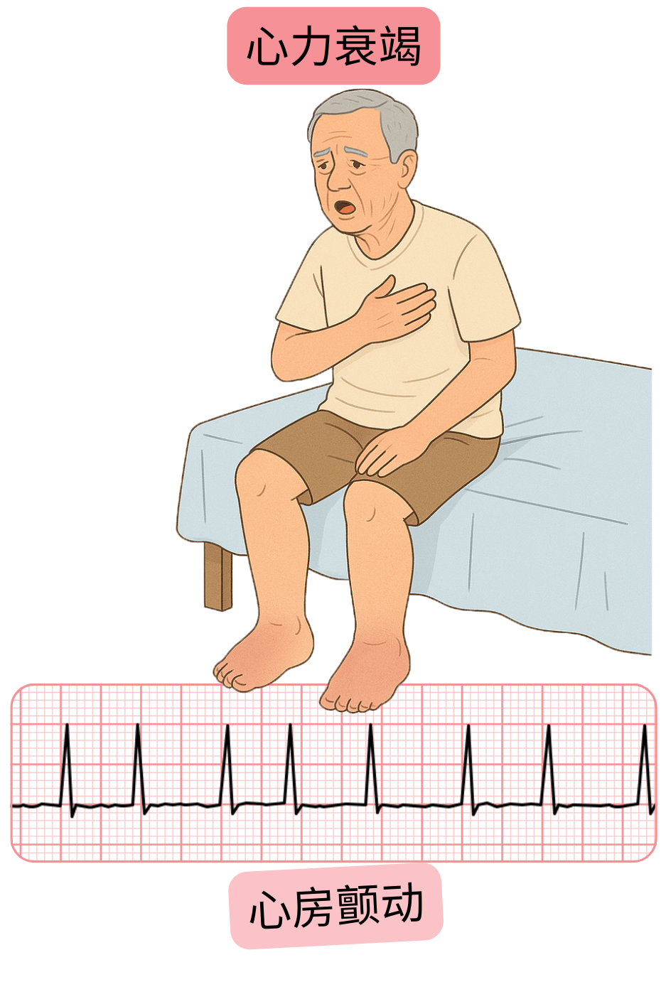示意图展示心房颤动与心力衰竭之间的关系，并附有心律失常的心电图记录。