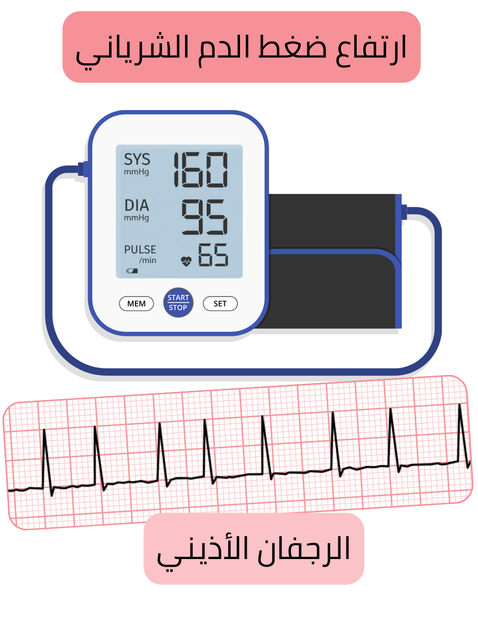 رسم توضيحي يبيّن العلاقة بين ارتفاع ضغط الدم الشرياني والرجفان الأذيني مع تسجيل تخطيط القلب لاضطراب النظم.