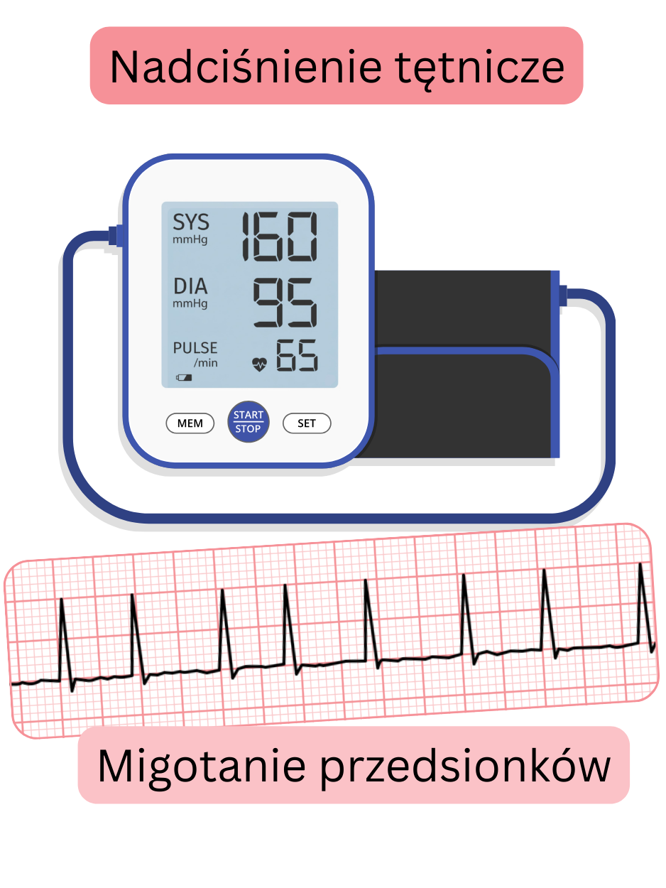 Ilustracja przedstawiająca związek między nadciśnieniem tętniczym a migotaniem przedsionków wraz z zapisem EKG arytmii.