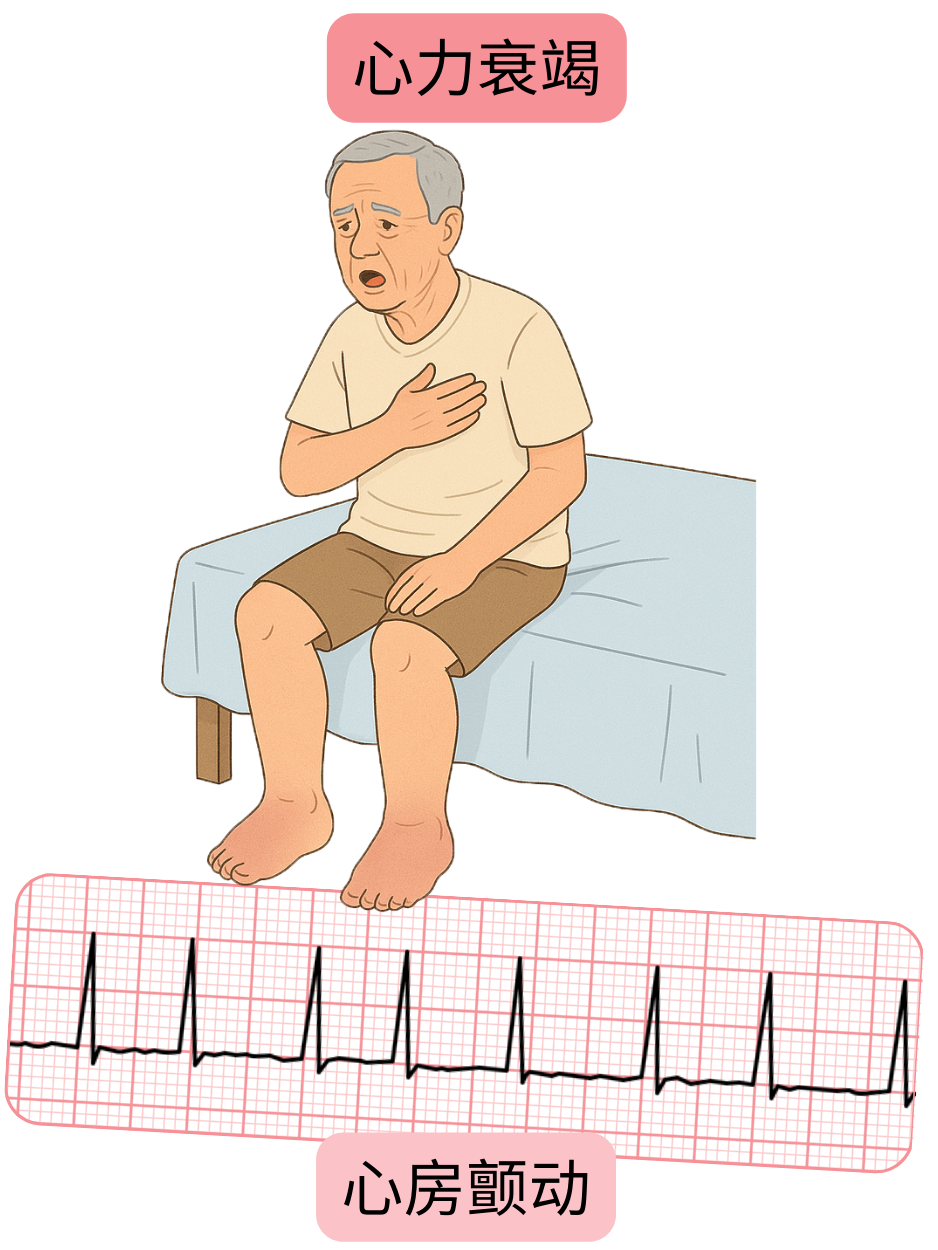 示意图展示心力衰竭作为心房颤动的重要合并症，并附有心律失常的心电图记录。