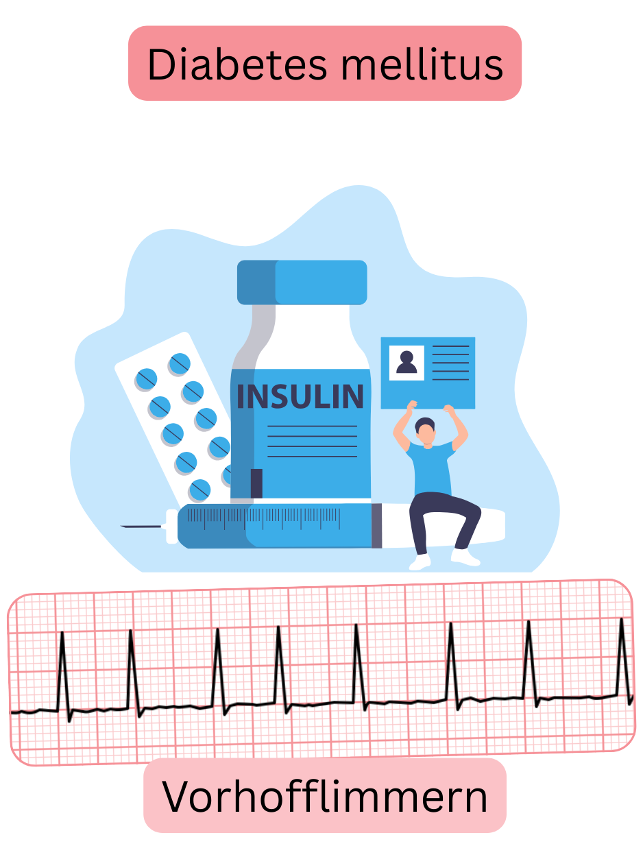 Illustration zur Darstellung des Diabetes mellitus als bedeutenden Risikofaktor für Vorhofflimmern mit EKG-Aufzeichnung der Arrhythmie.
