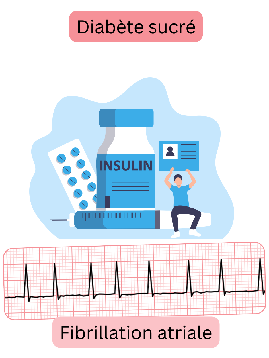Illustration montrant le diabète sucré comme un facteur de risque majeur de la fibrillation atriale, avec un enregistrement ECG de l’arythmie.