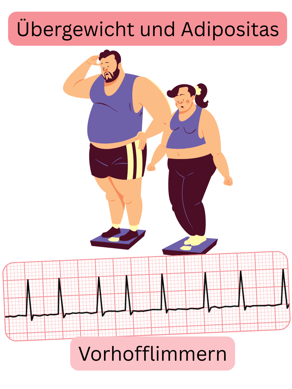 Illustration zur Darstellung von Übergewicht und Adipositas als bedeutende Risikofaktoren für Vorhofflimmern mit EKG-Aufzeichnung der Arrhythmie.