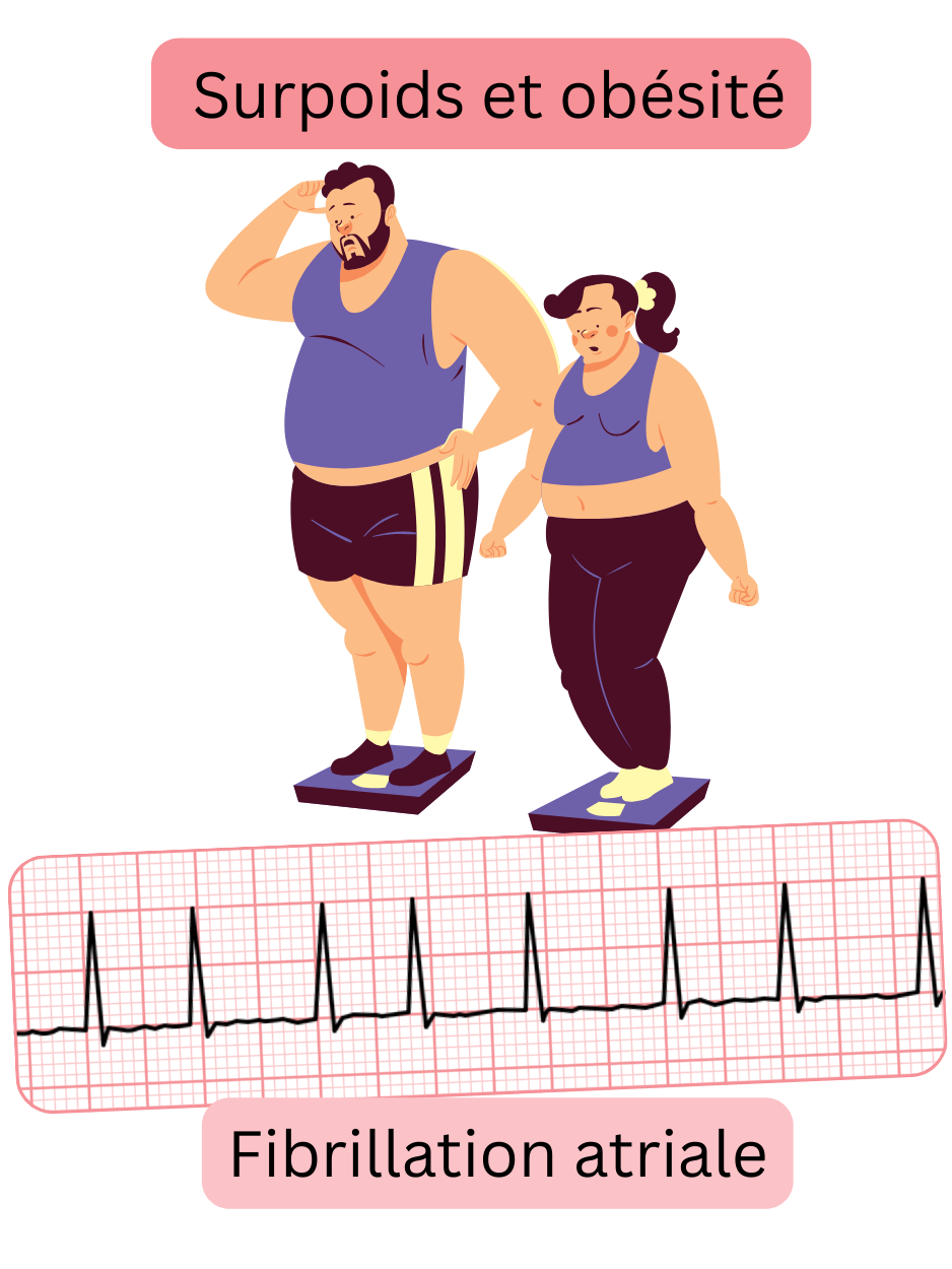 Illustration montrant le surpoids et l’obésité comme des facteurs de risque majeurs de la fibrillation atriale, avec un enregistrement ECG de l’arythmie.
