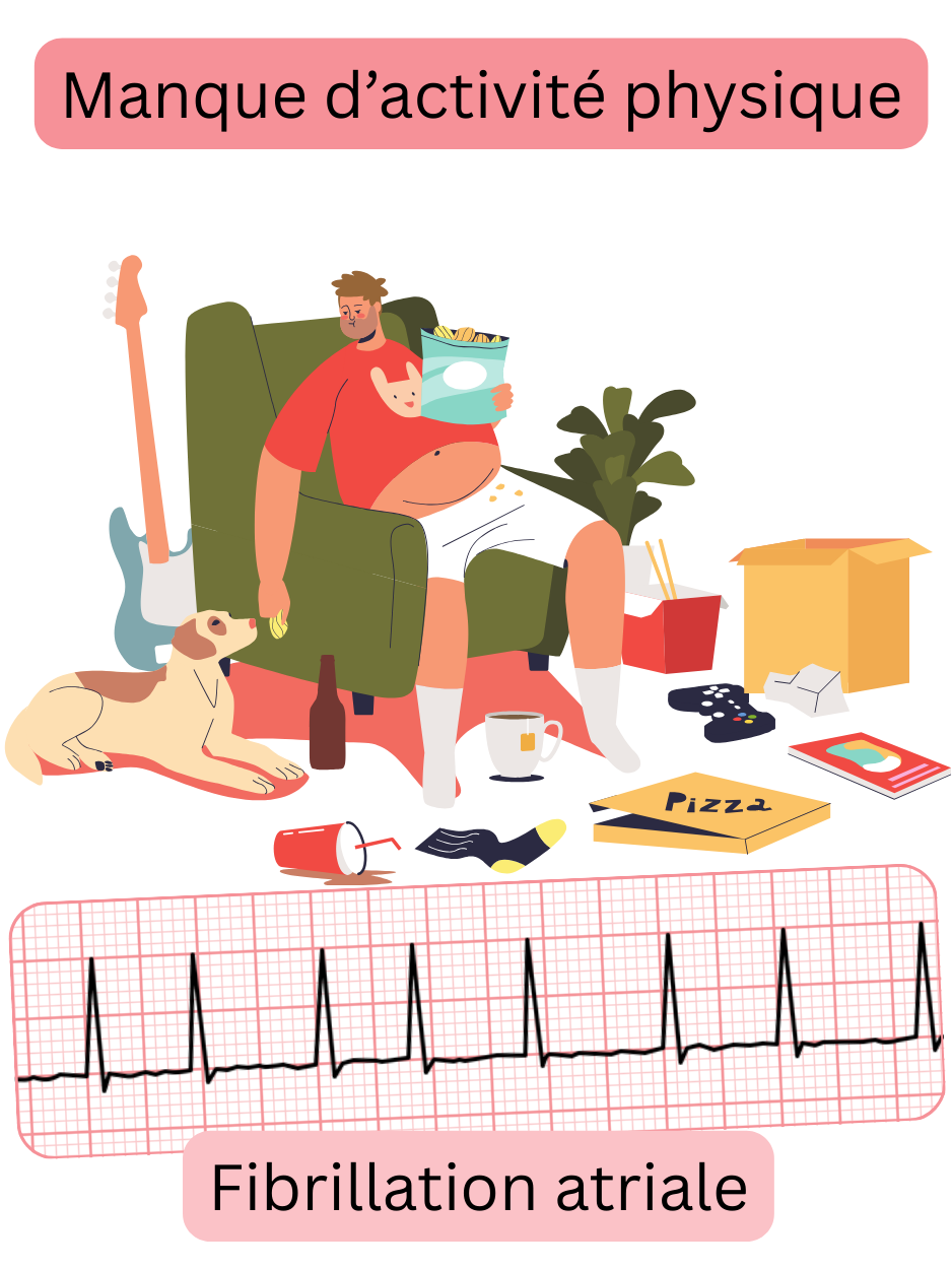 Illustration montrant le manque d’activité physique comme facteur de risque de la fibrillation atriale, avec un enregistrement ECG de l’arythmie.