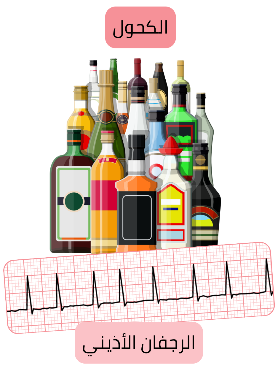 رسم توضيحي يبيّن الاستهلاك المفرط للكحول كعامل خطر مهم للرجفان الأذيني مع تسجيل تخطيط القلب لاضطراب النظم.