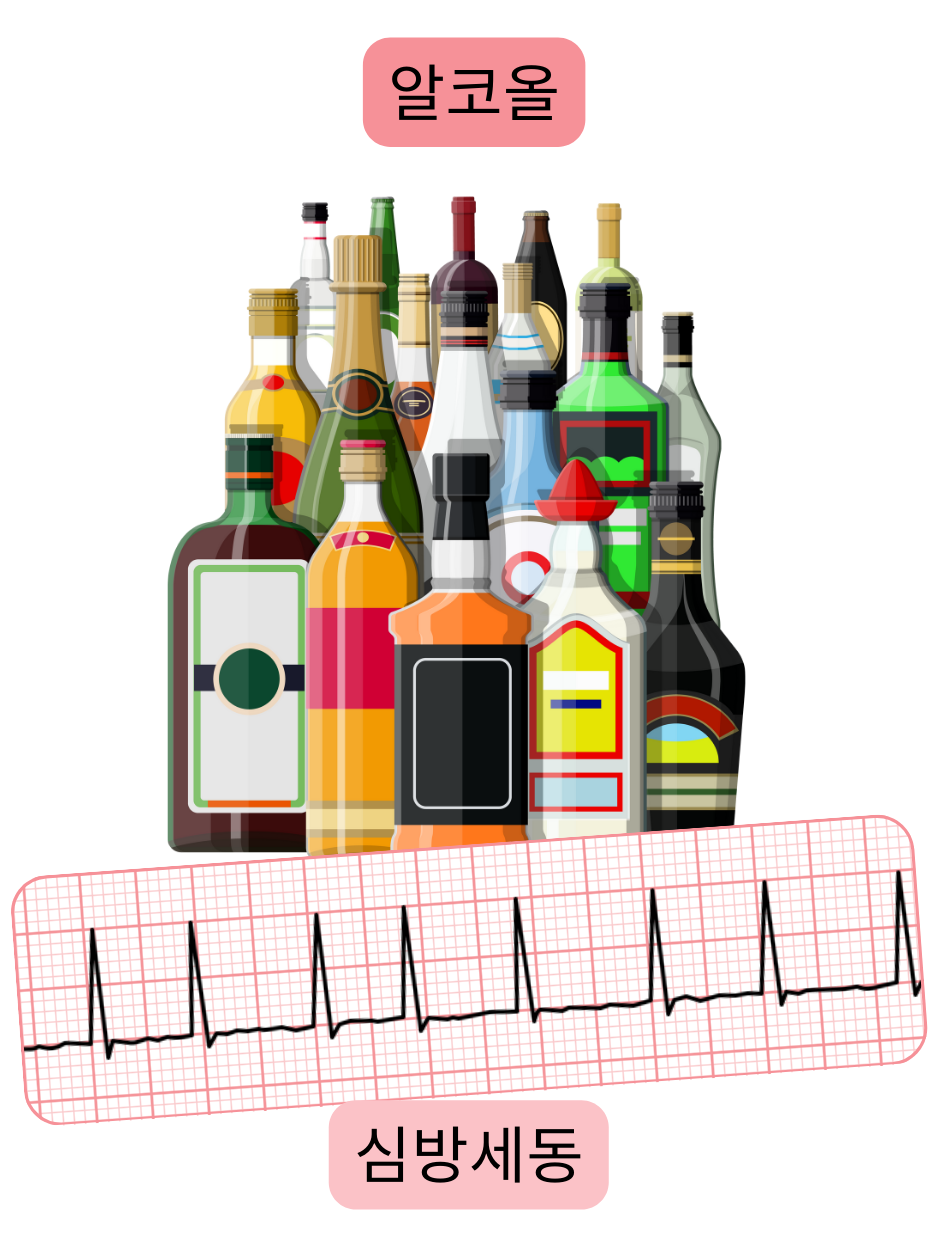 과도한 알코올 섭취가 심방세동의 중요한 위험 요인임을 부정맥의 심전도 기록과 함께 보여주는 그림.