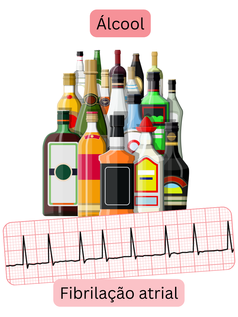 Ilustração que mostra o consumo excessivo de álcool como um fator de risco significativo para a fibrilação atrial, com registo ECG da arritmia.