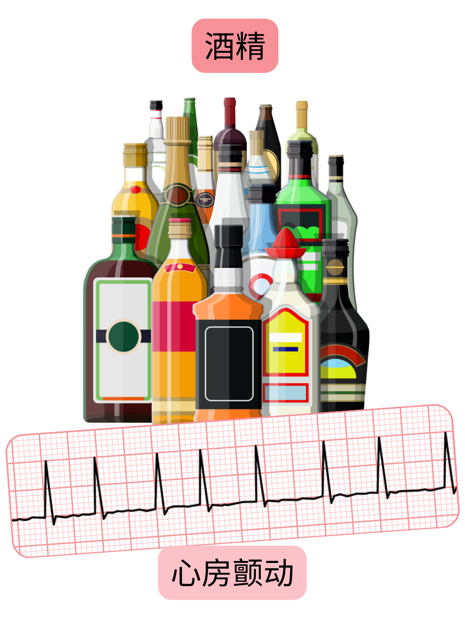 示意图展示过量饮酒作为心房颤动的重要危险因素，并附有心律失常的心电图记录。