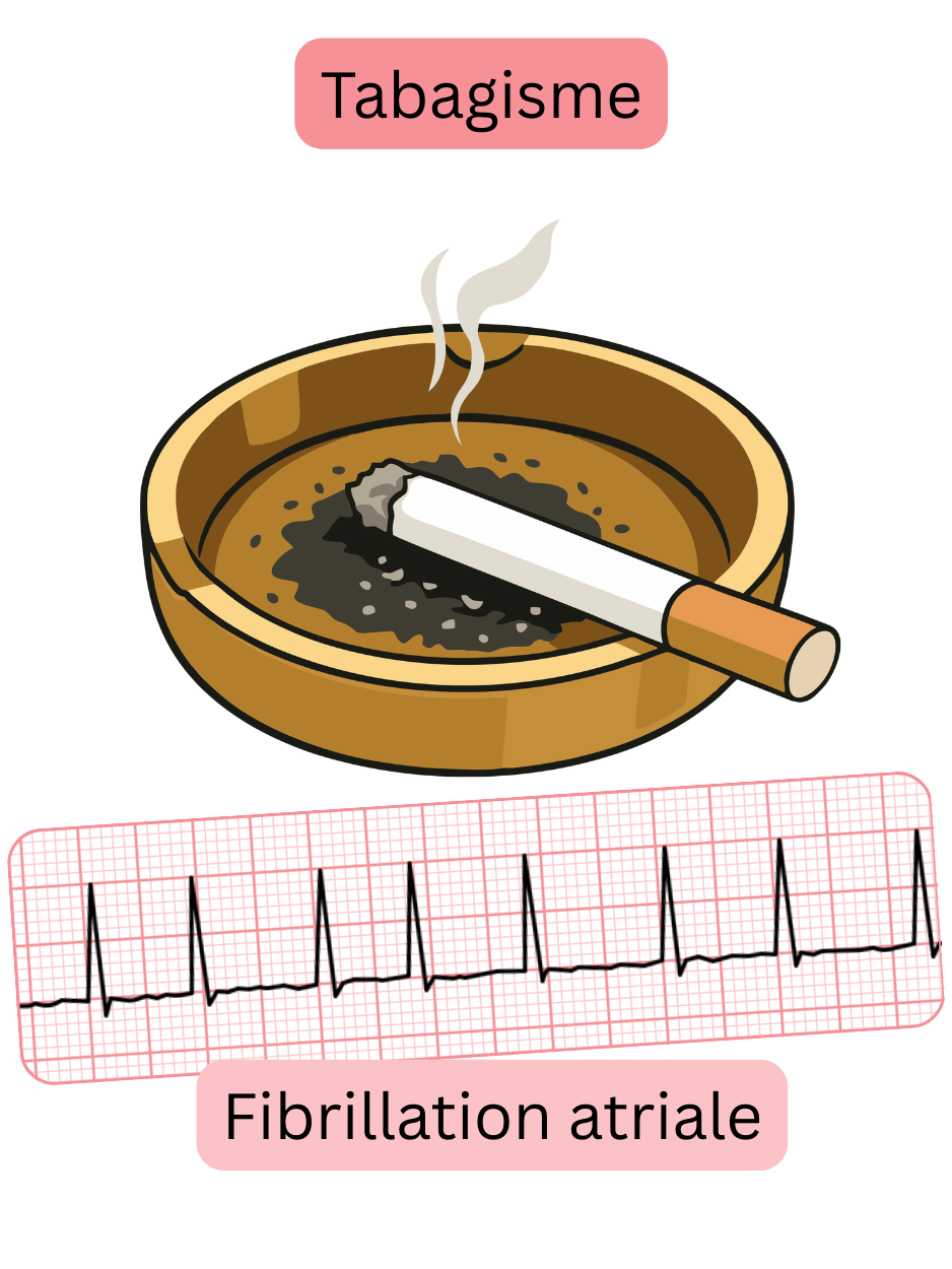 Illustration montrant le tabagisme comme un facteur de risque majeur de la fibrillation atriale, avec un enregistrement ECG de l’arythmie.
