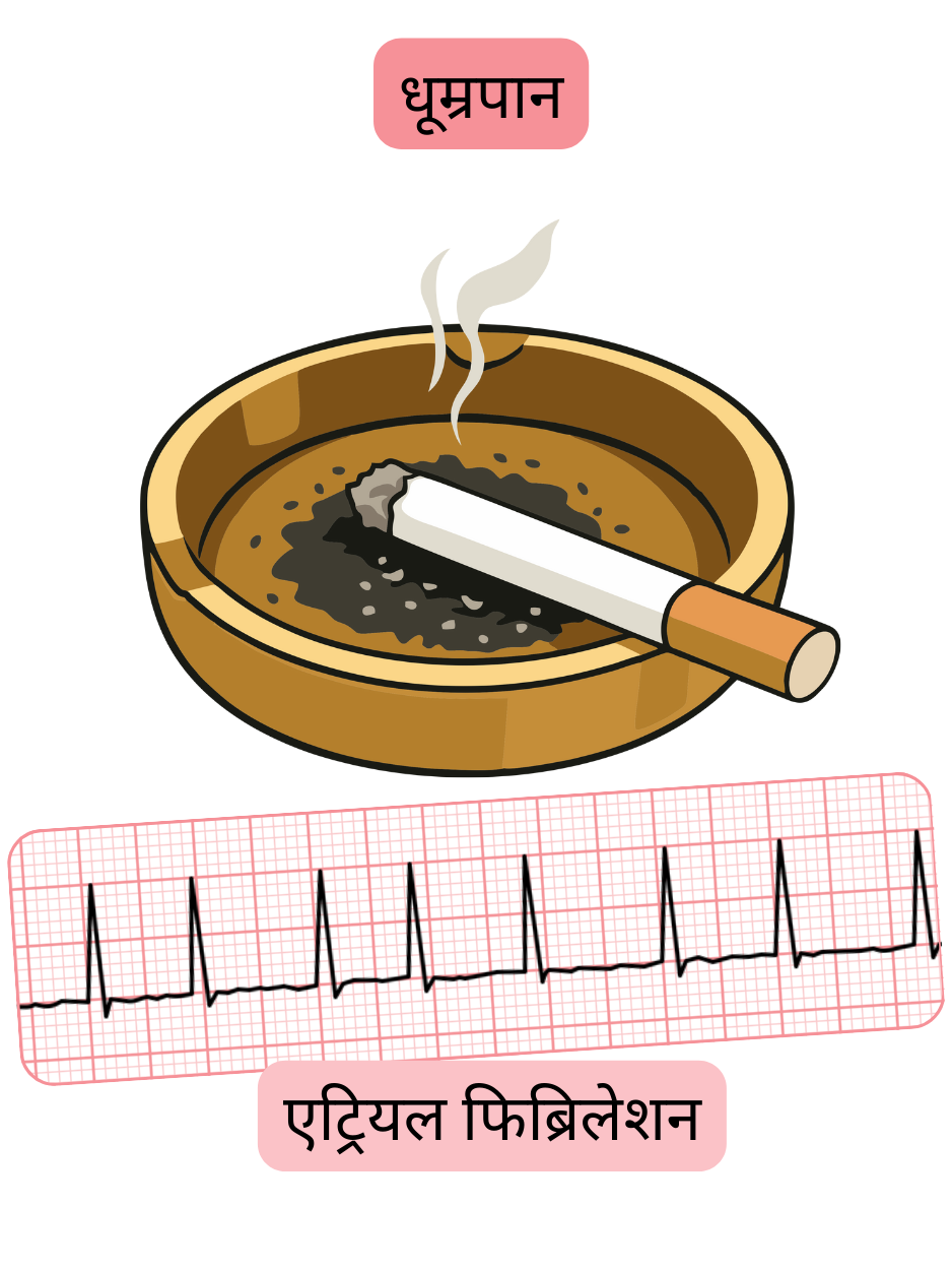 चित्रण जो धूम्रपान को एट्रियल फिब्रिलेशन का एक महत्वपूर्ण जोखिम कारक दर्शाता है, साथ में अतालता का ईसीजी रिकॉर्ड।