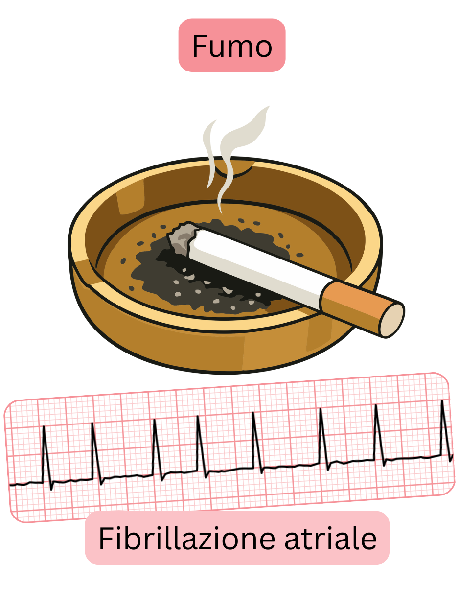 Illustrazione che raffigura il fumo come un importante fattore di rischio per la fibrillazione atriale, con registrazione ECG dell’aritmia.