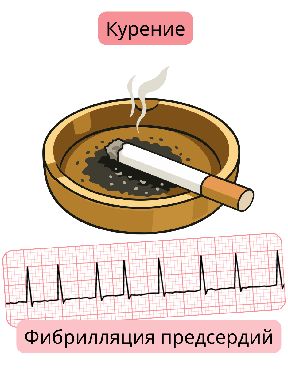 Иллюстрация, демонстрирующая курение как значимый фактор риска фибрилляции предсердий с ЭКГ-записью аритмии.