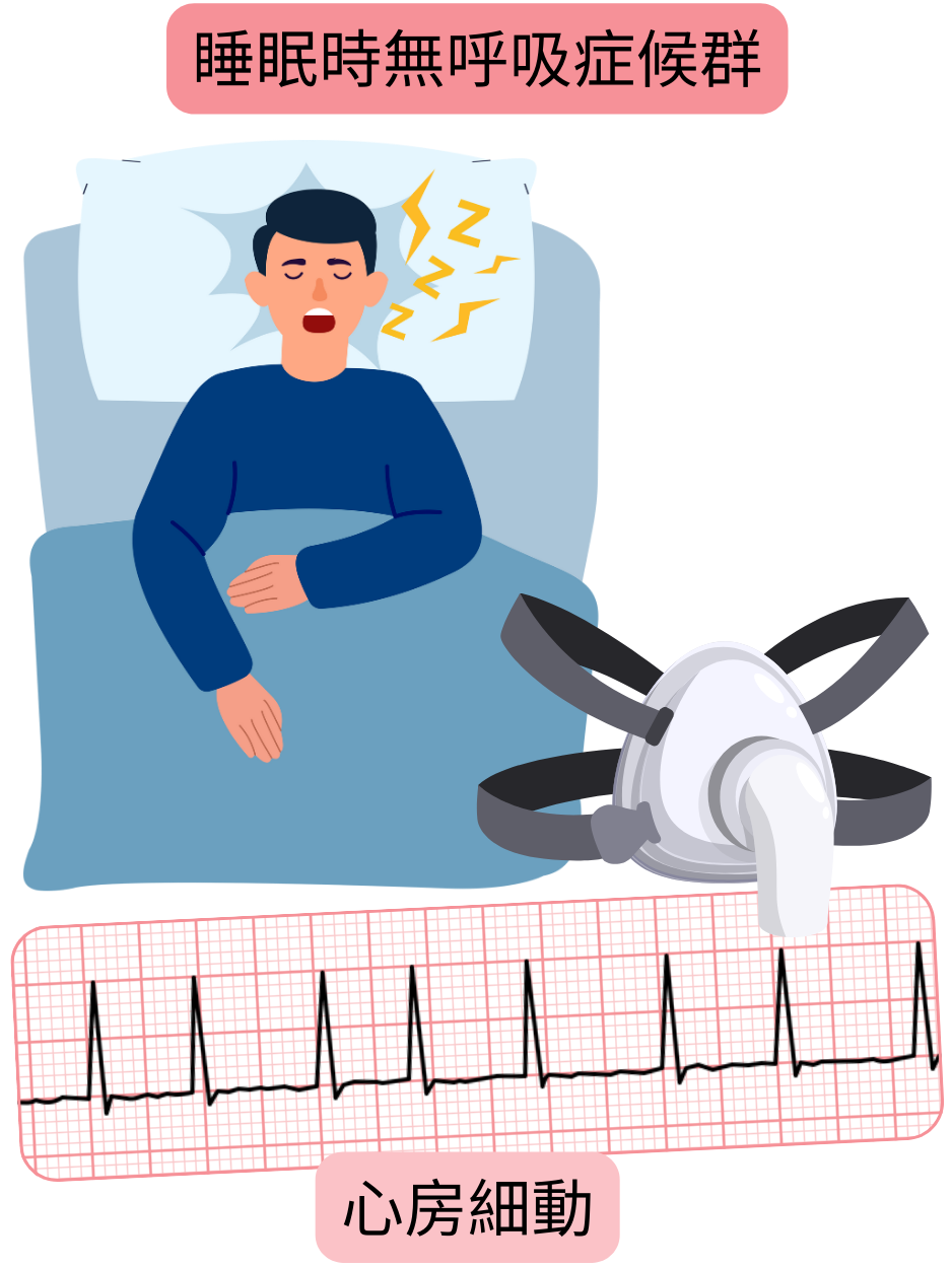 睡眠時無呼吸症候群が心房細動の重要な危険因子であることを、不整脈の心電図記録とともに示す図。