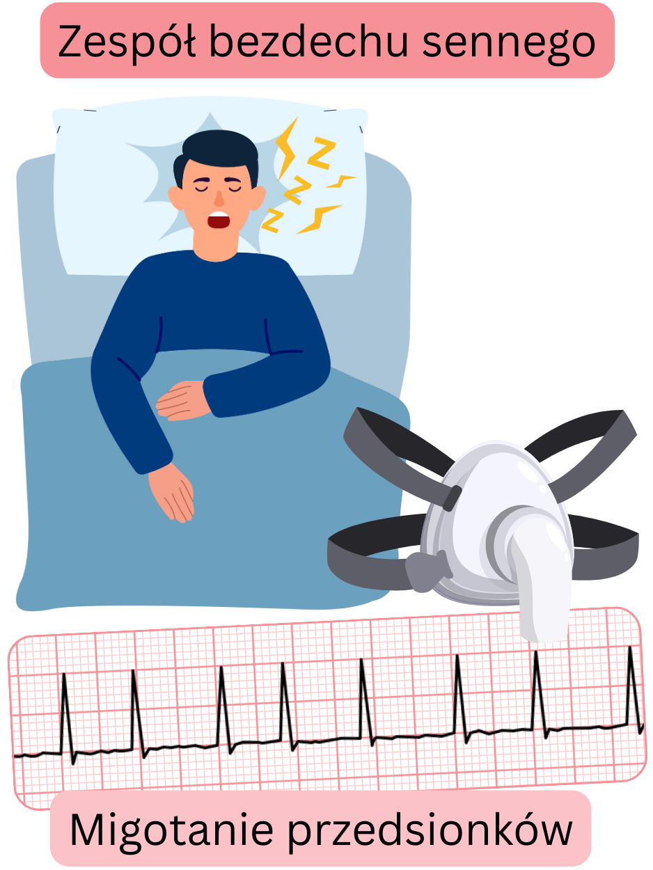 Ilustracja przedstawiająca zespół bezdechu sennego jako istotny czynnik ryzyka migotania przedsionków wraz z zapisem EKG arytmii.