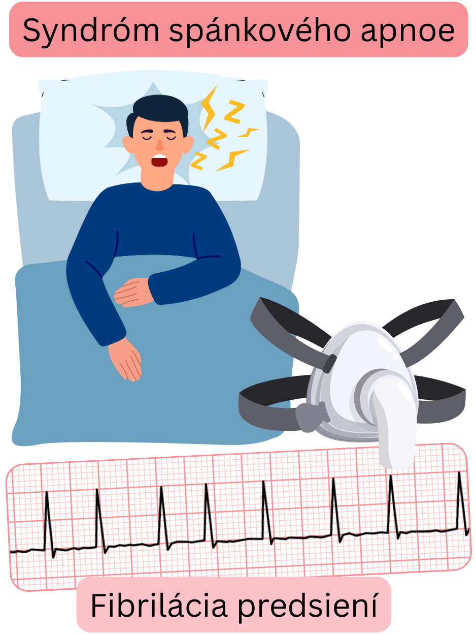 Ilustrácia znázorňujúca syndróm spánkového apnoe ako významný rizikový faktor fibrilácie predsiení s EKG záznamom arytmie.