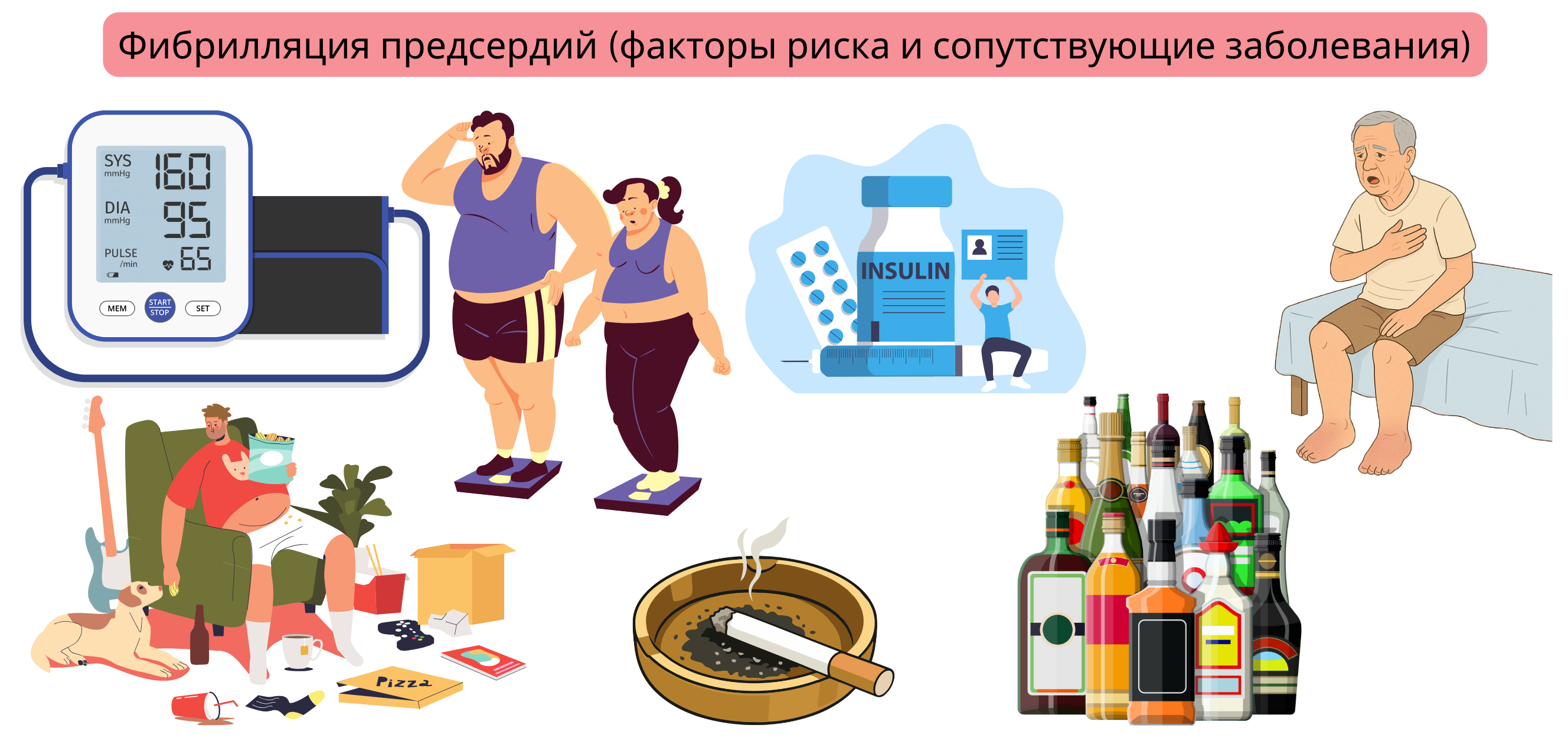 Инфографика, демонстрирующая факторы риска и сопутствующие заболевания фибрилляции предсердий, включая артериальную гипертензию, ожирение, диабет, сердечную недостаточность, курение и чрезмерное употребление алкоголя.