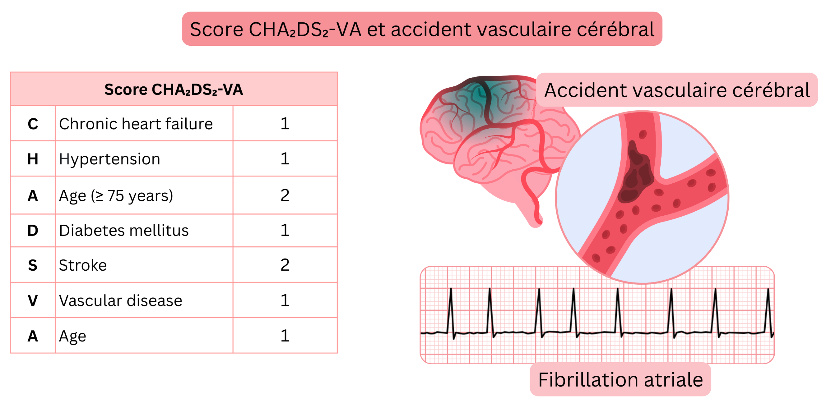 Infographie illustrant le score CHA₂DS₂-VA avec les facteurs de risque individuels et son lien avec le risque d’accident vasculaire cérébral ischémique en fibrillation atriale.