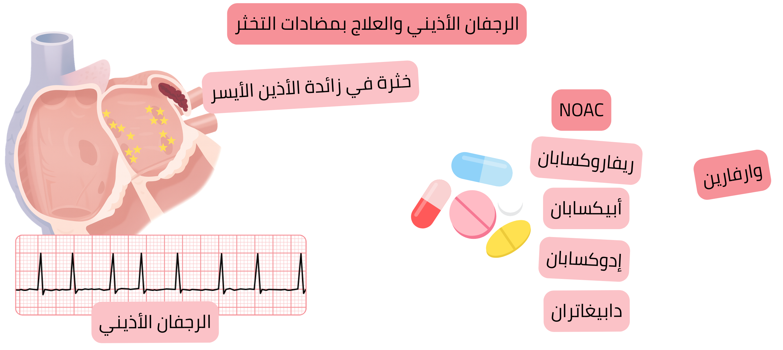 إنفوجرافيك يوضح الرجفان الأذيني مع خثرة في زائدة الأذين الأيسر ومبادئ العلاج المضاد للتخثر بما في ذلك مضادات التخثر الفموية الحديثة والوارفارين.