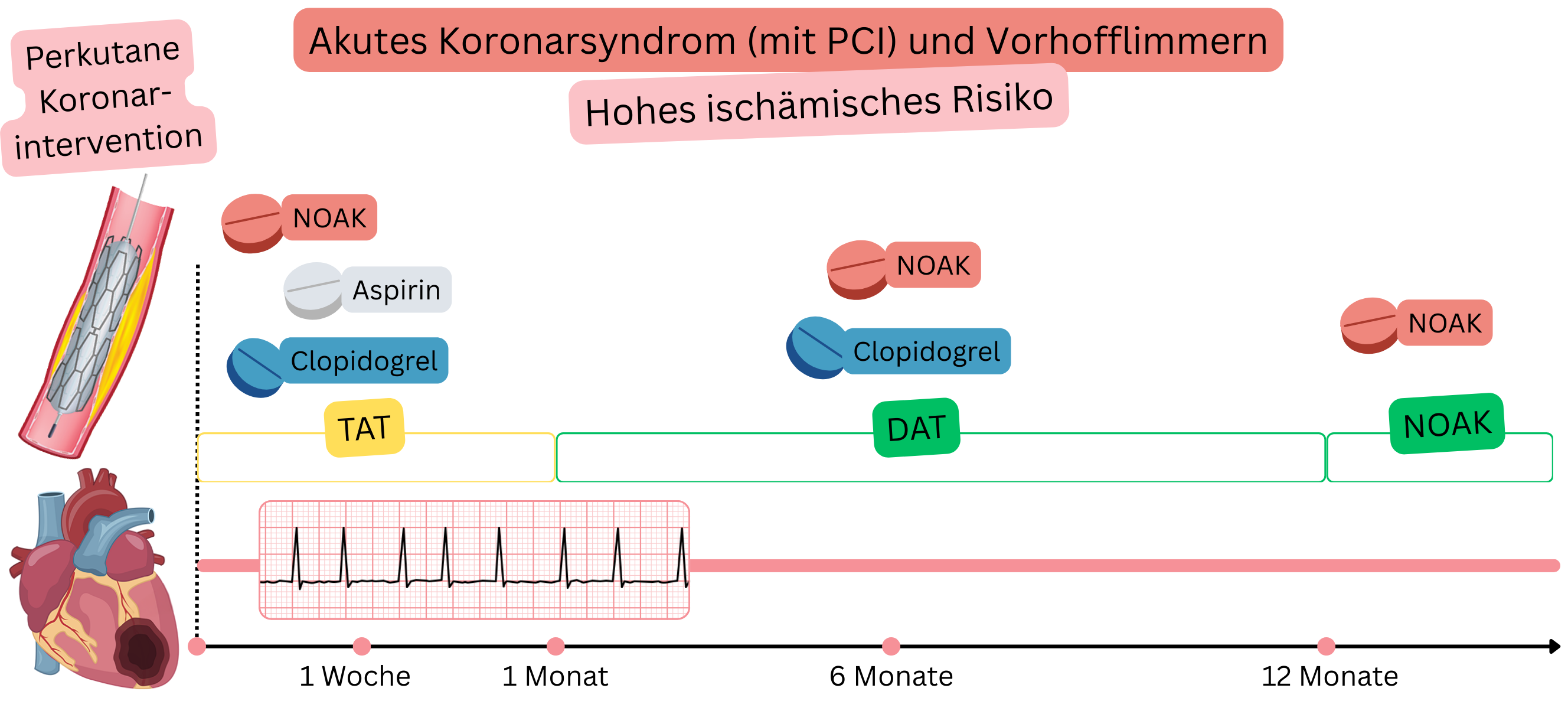 Infografik zur Darstellung der antithrombotischen Therapiestrategie bei Patienten mit akutem Koronarsyndrom nach PCI und Vorhofflimmern bei hohem ischämischem Risiko mit initialer TAT, anschließender DAT und Übergang zur NOAK-Monotherapie.