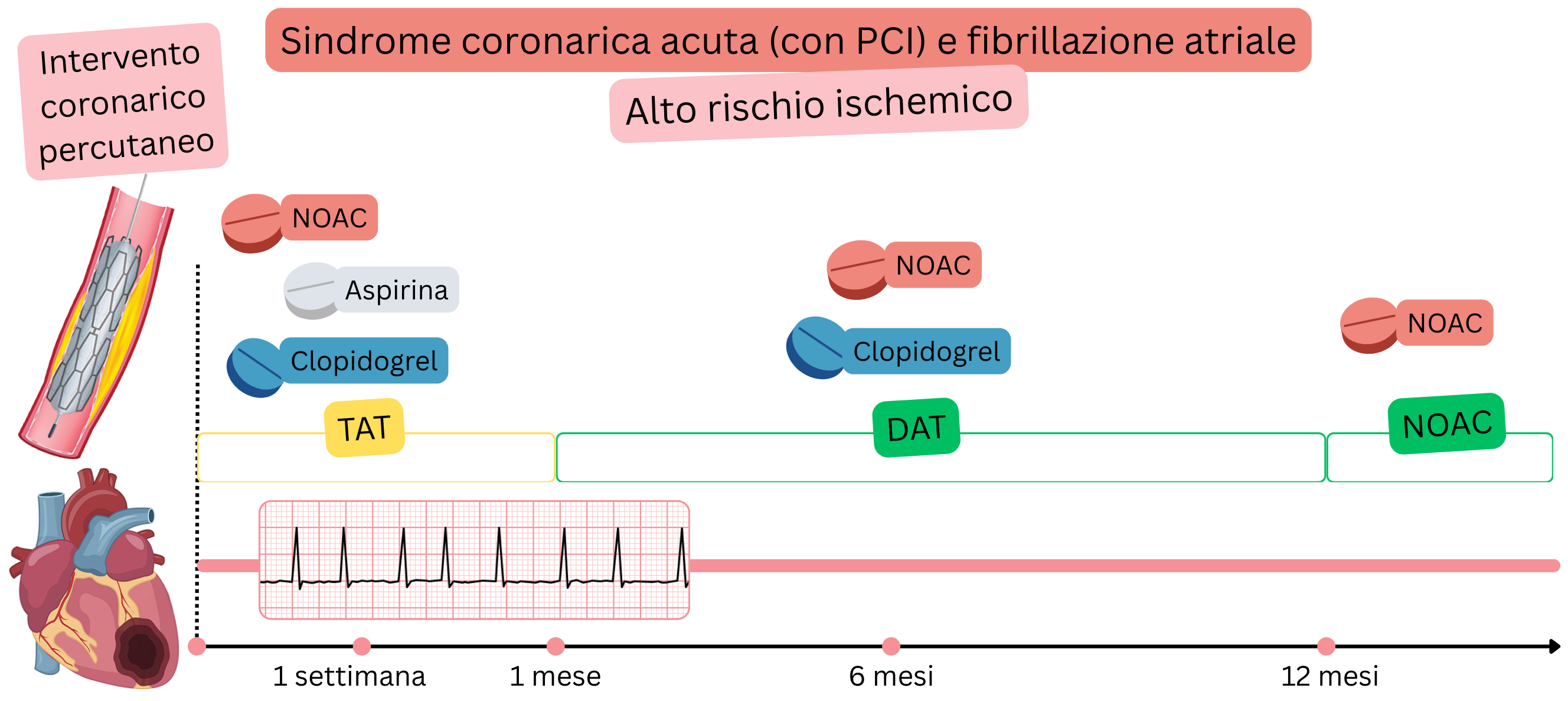 Infografica che illustra la strategia di trattamento antitrombotico nei pazienti con sindrome coronarica acuta dopo PCI e fibrillazione atriale ad alto rischio ischemico, con TAT iniziale, seguita da DAT e transizione alla monoterapia con NOAC.