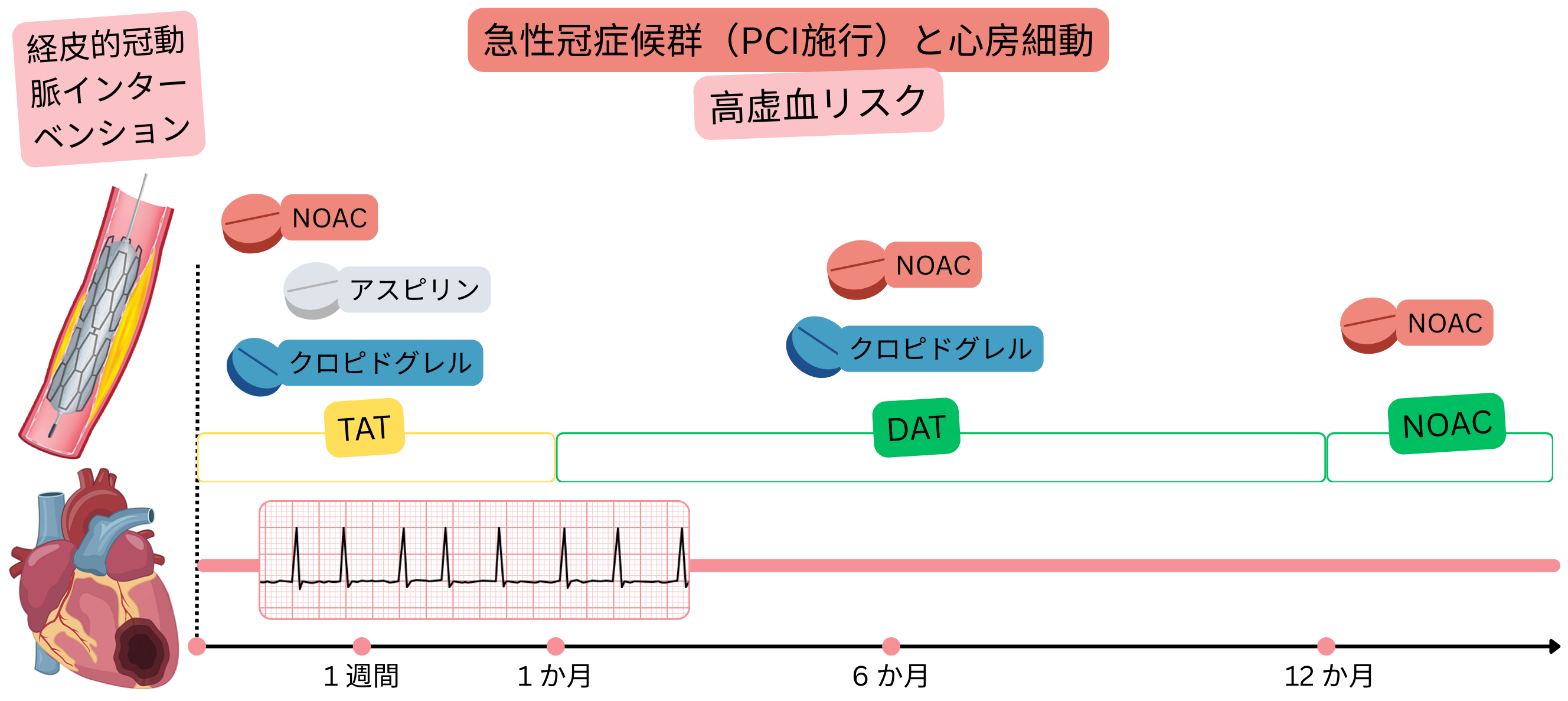 PCI後の急性冠症候群と心房細動を有し虚血リスクが高い患者における抗血栓治療戦略として、初期TAT、続くDAT、そして最終的なNOAC単剤療法への移行を示すインフォグラフィック。