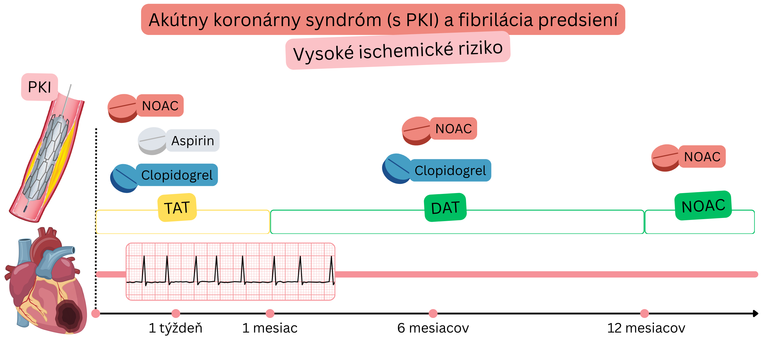 Infografika znázorňujúca stratégiu antitrombotickej liečby u pacientov s akútnym koronárnym syndrómom po PKI a fibriláciou predsiení pri vysokom ischemickom riziku s úvodnou TAT, následnou DAT a prechodom na monoterapiu NOAC.