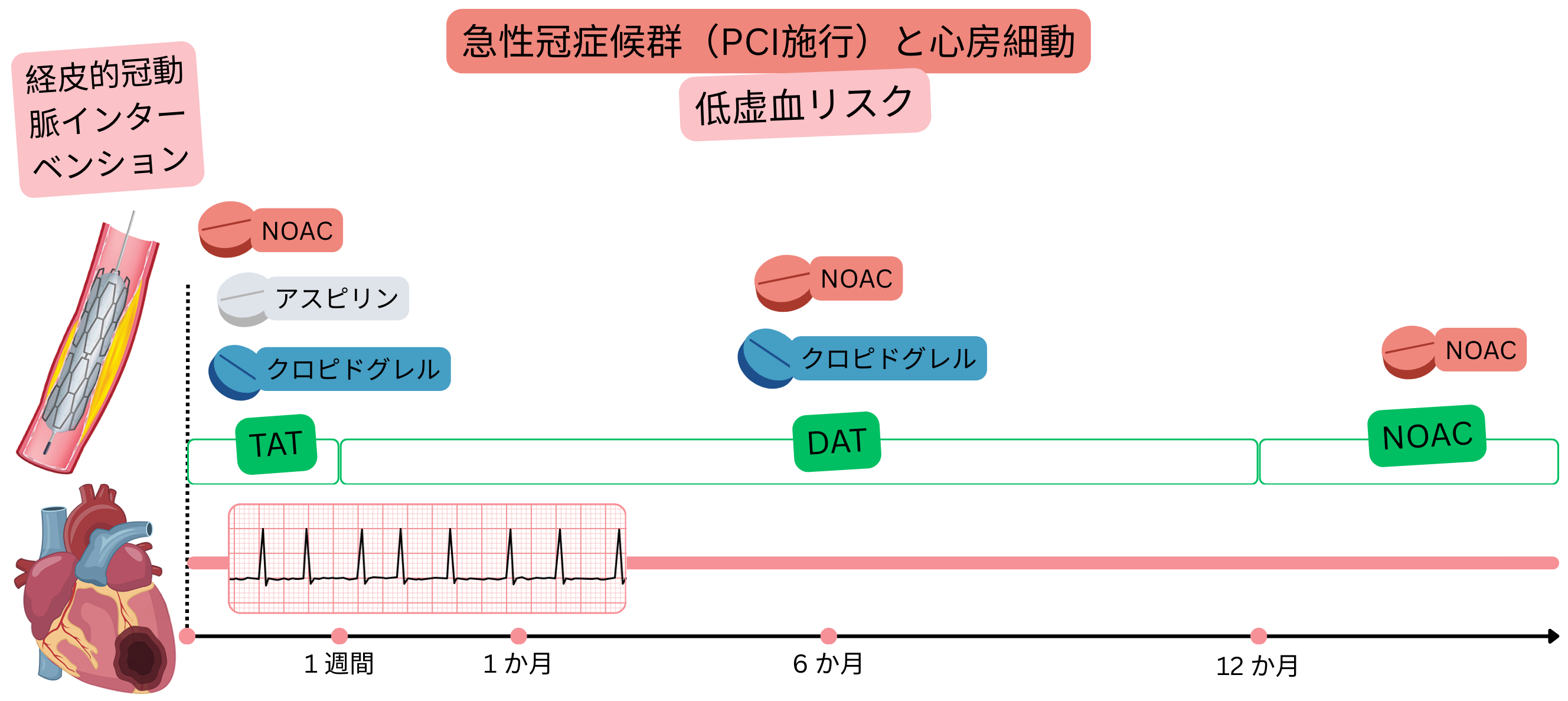 PCI後の急性冠症候群と心房細動を有し虚血リスクが低い患者における抗血栓治療戦略として、TATからDATへの段階的移行および最終的なNOAC単剤療法を示すインフォグラフィック。