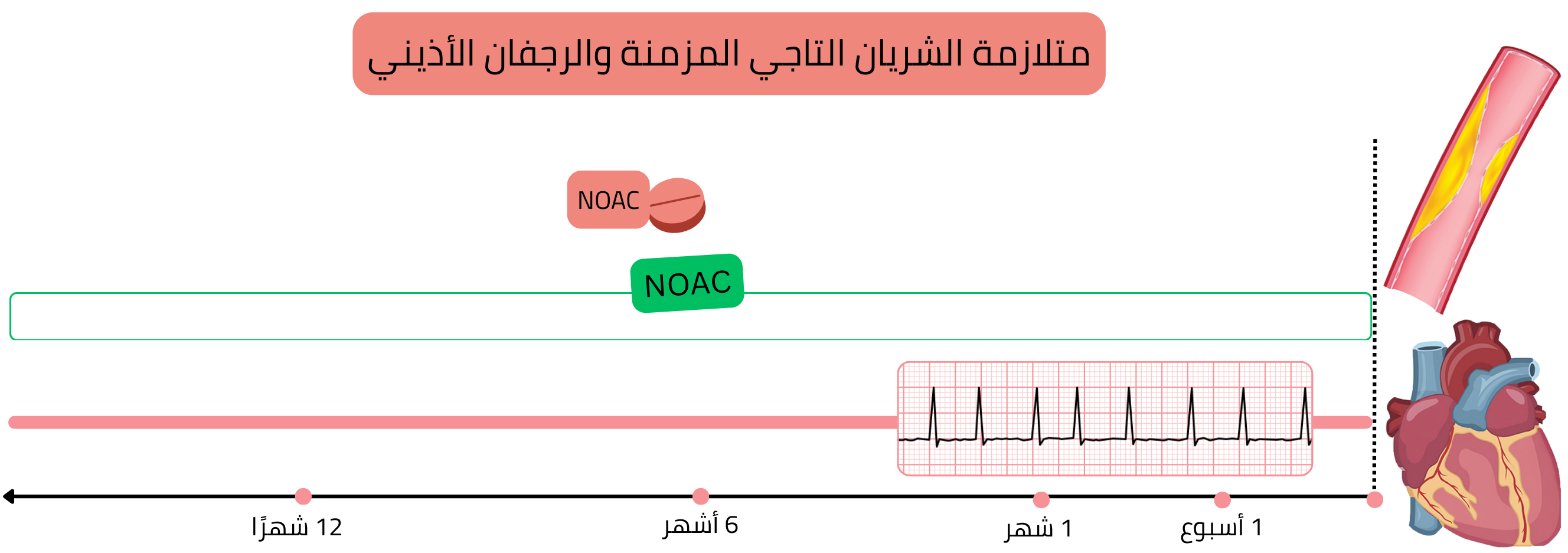 إنفوجرافيك يوضح علاج الرجفان الأذيني في المتلازمة التاجية المزمنة دون تدخل تاجي عبر الجلد حديث، باستخدام العلاج الأحادي طويل الأمد بمضادات التخثر الفموية الحديثة.