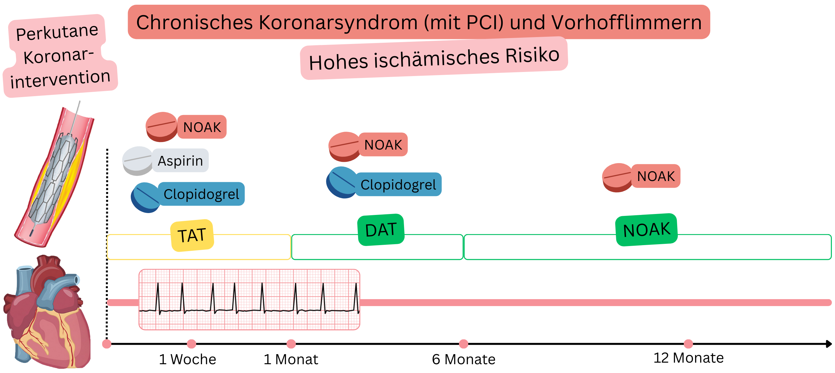 Infografik zur Darstellung der antithrombotischen Therapiestrategie bei Patienten mit chronischem Koronarsyndrom nach PCI und Vorhofflimmern bei hohem ischämischem Risiko mit initialer TAT, anschließender DAT und Übergang zur NOAK-Monotherapie.