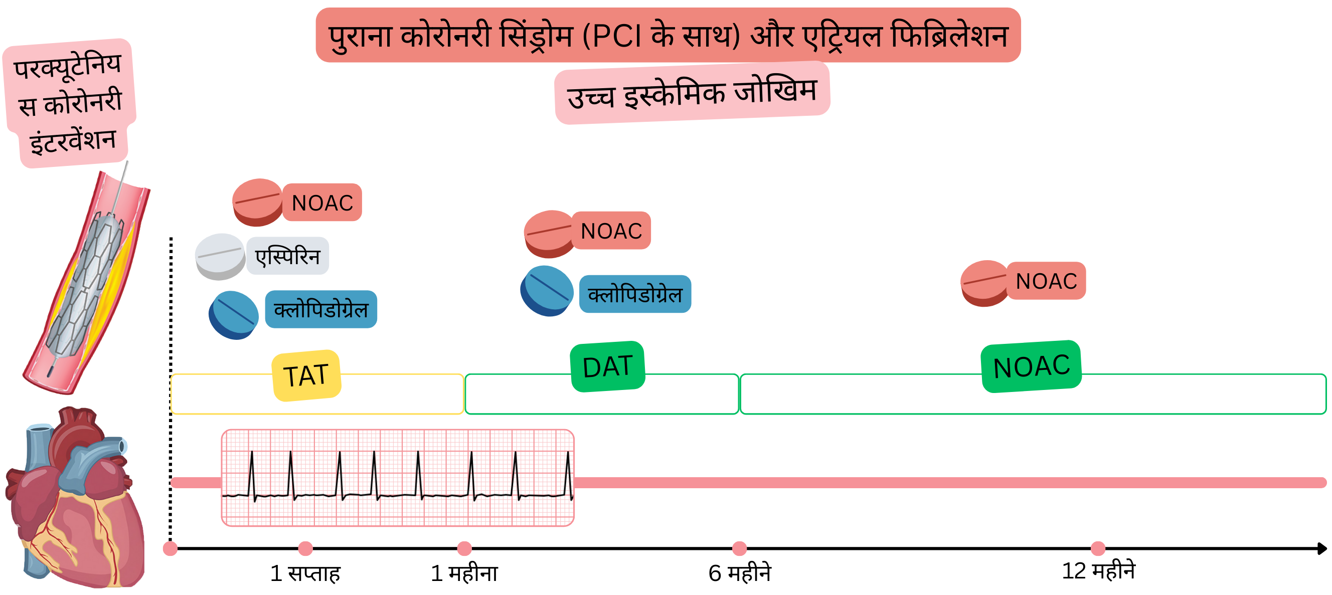 यह इन्फोग्राफिक पीसीआई के बाद क्रॉनिक कोरोनरी सिंड्रोम और एट्रियल फिब्रिलेशन वाले उच्च इस्केमिक जोखिम के रोगियों में एंटीथ्रोम्बोटिक उपचार रणनीति को दर्शाता है, जिसमें प्रारंभिक टीएटी, इसके बाद डीएटी और अंततः NOAC मोनोथेरेपी शामिल है।