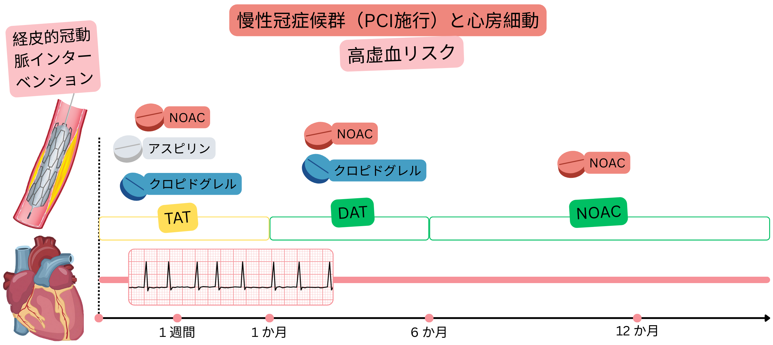 PCI後の慢性冠動脈症候群と心房細動を有し虚血リスクが高い患者における抗血栓治療戦略として、初期TAT、続くDAT、そして最終的なNOAC単剤療法への移行を示すインフォグラフィック。