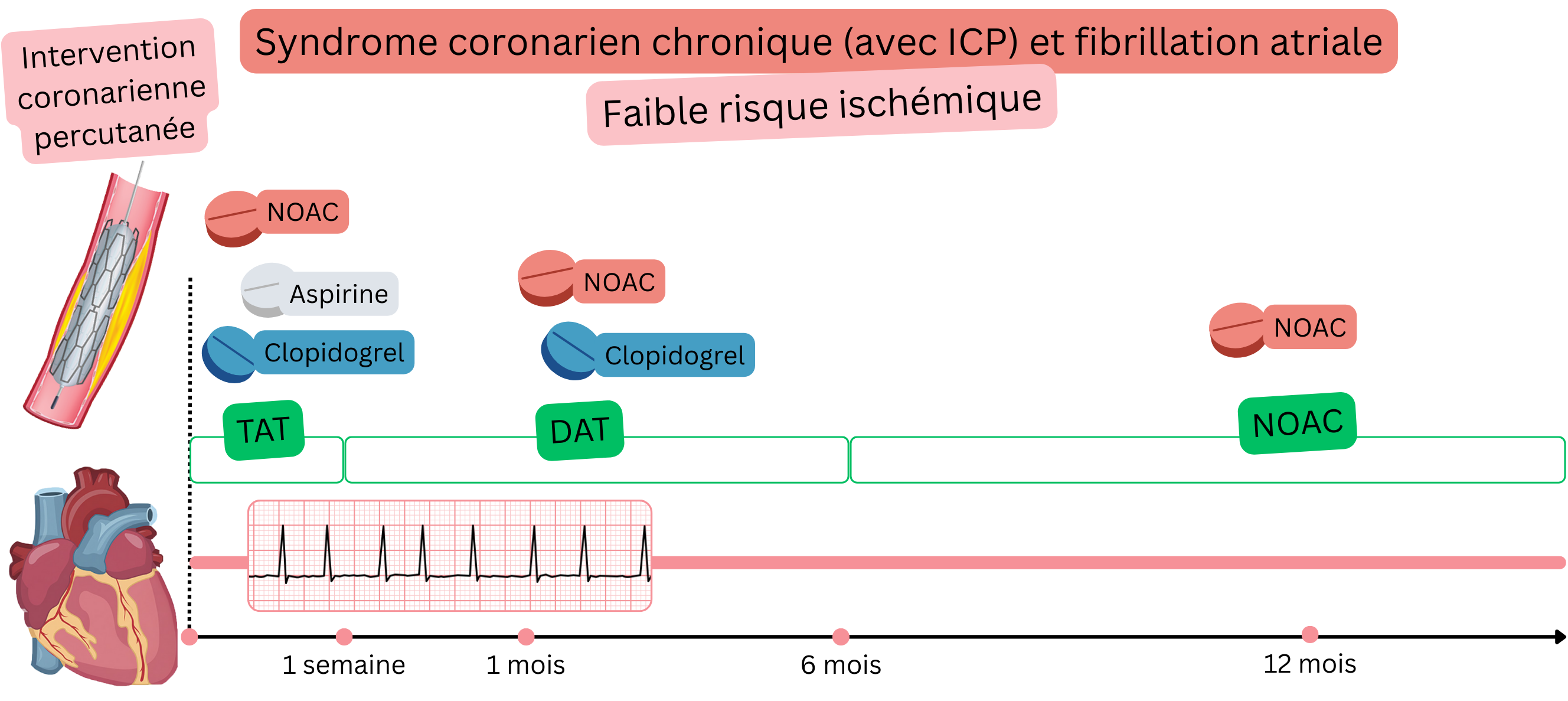 Infographie illustrant la stratégie de traitement antithrombotique chez les patients atteints de syndrome coronarien chronique après ICP et fibrillation atriale à faible risque ischémique, avec passage de la TAT à la DAT puis à une monothérapie par AOD.
