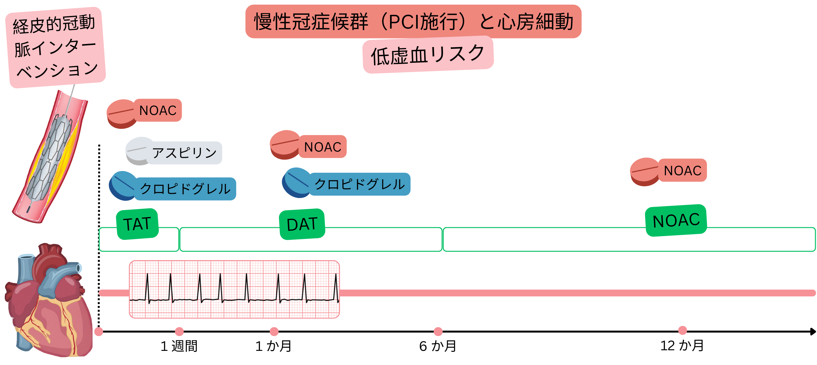 PCI後の慢性冠動脈症候群と心房細動を有し虚血リスクが低い患者における抗血栓治療戦略として、TATからDATへの移行および最終的なNOAC単剤療法を示すインフォグラフィック。
