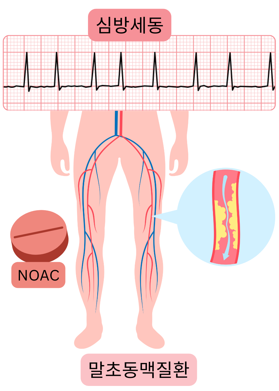 하지 말초동맥질환과 동맥경화성 병변을 동반한 심방세동과 NOAC 항응고 치료 적응증을 보여주는 그림.