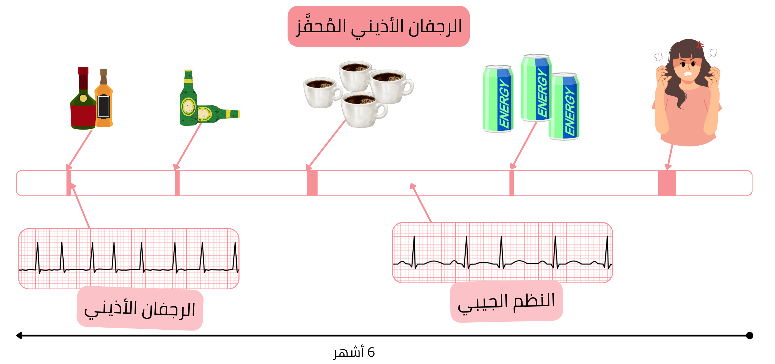 إنفوجرافيك يوضح الرجفان الأذيني المُحفَّز بالكحول والكافيين ومشروبات الطاقة والضغط النفسي، مع الانتقال بين الرجفان الأذيني والنظم الجيبي بمرور الوقت.