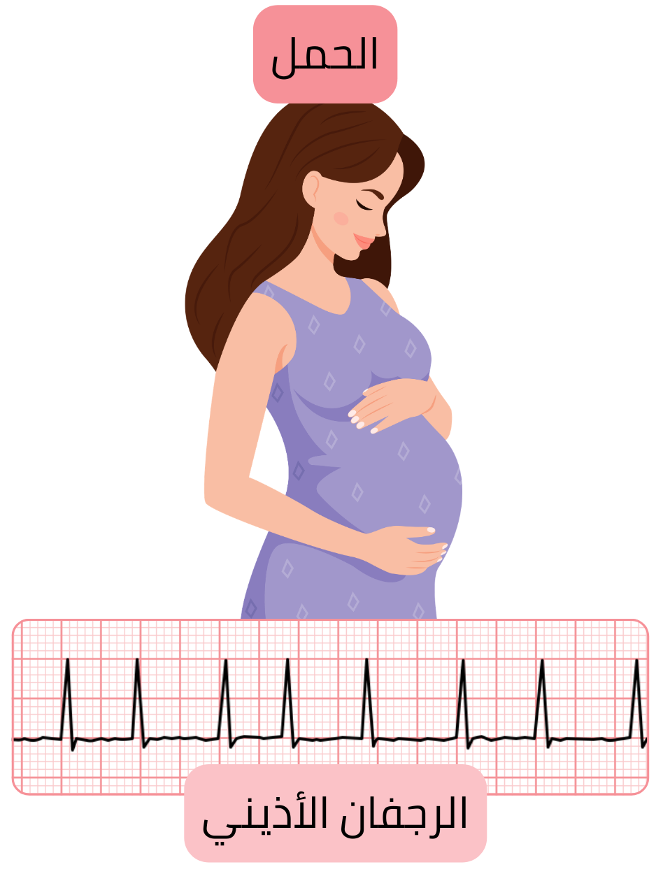 رسم توضيحي للرجفان الأذيني لدى امرأة حامل مع توثيق اضطراب النظم بتخطيط القلب أثناء الحمل.