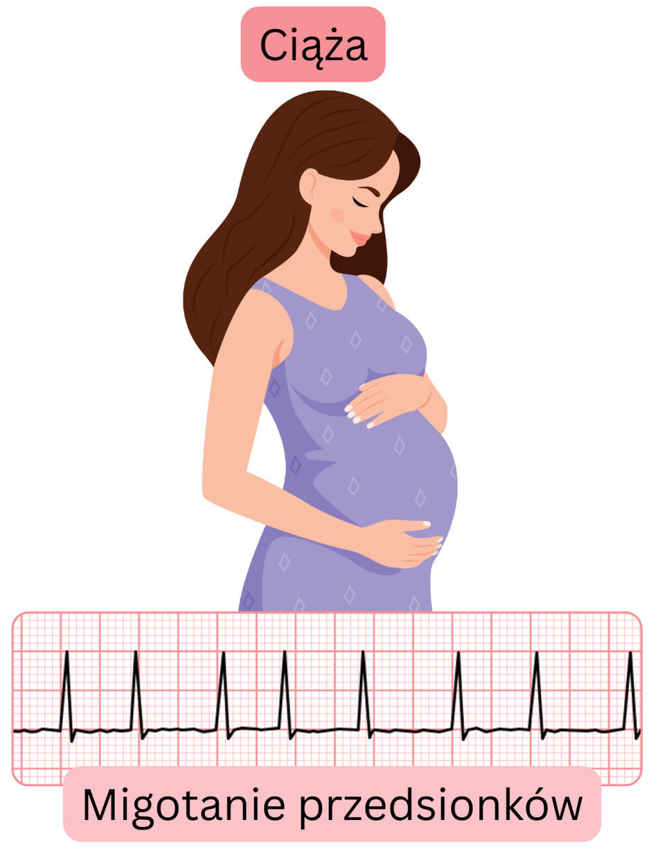 Ilustracja migotania przedsionków u kobiety ciężarnej z udokumentowanym zapisem EKG arytmii w czasie ciąży.