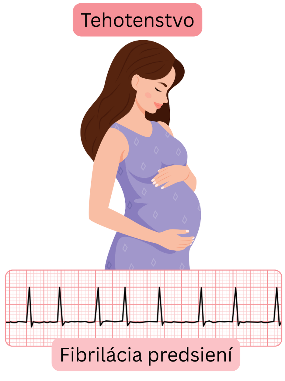 Ilustrácia fibrilácie predsiení u tehotnej ženy s dokumentovaným EKG záznamom arytmie počas gravidity.