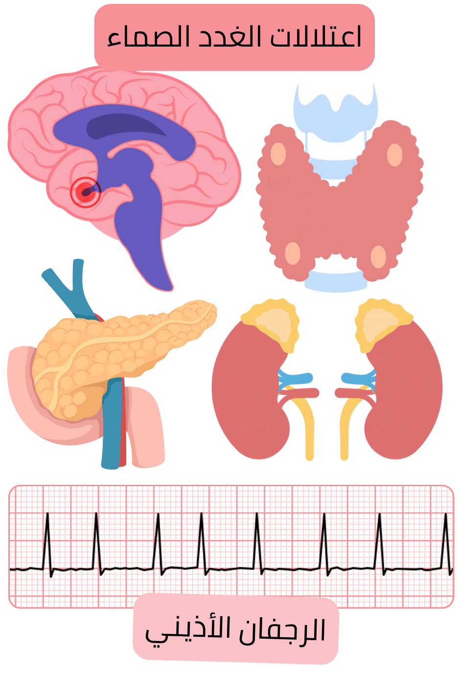 رسم توضيحي يبيّن اضطرابات الغدد الصماء بما في ذلك أمراض الغدة النخامية والدرقية والبنكرياس والغدد الكظرية كعوامل خطورة للرجفان الأذيني مع توثيق التخطيط الكهربائي للقلب لاضطراب النظم.