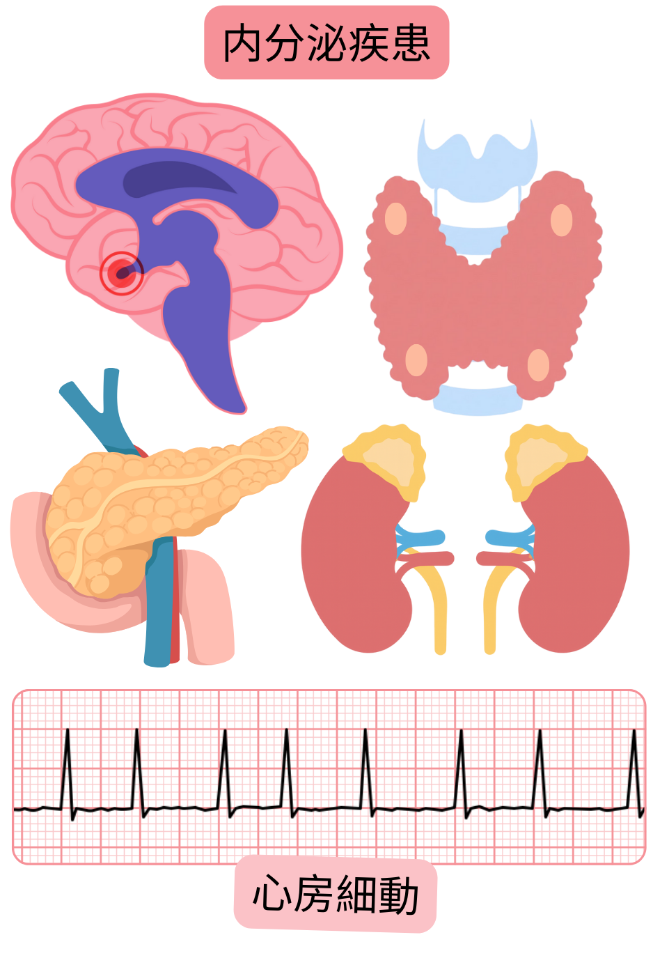 下垂体、甲状腺、膵臓、副腎の内分泌疾患を心房細動の危険因子として示し、不整脈の心電図所見を含む図。