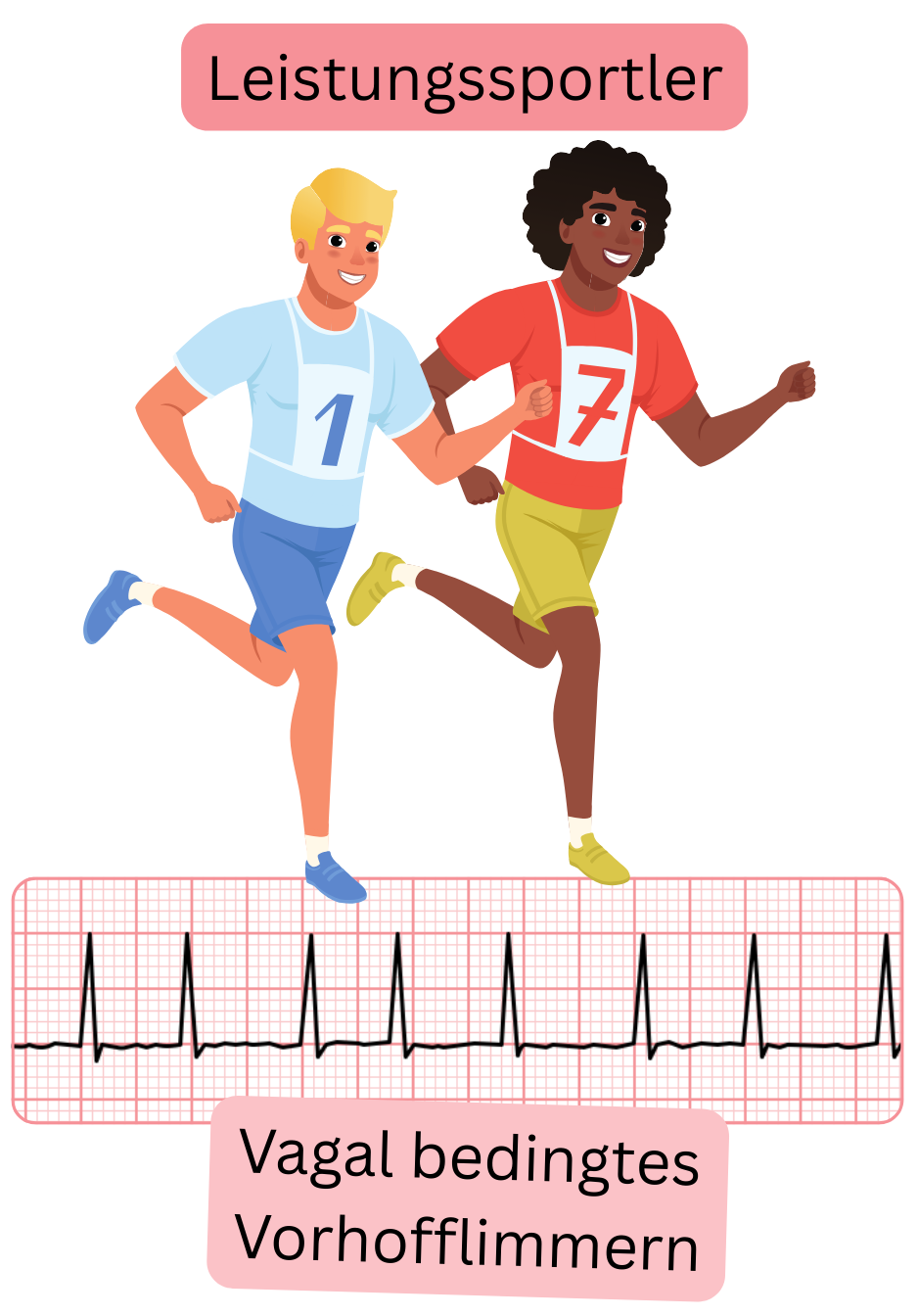Abbildung, die Leistungssportler mit vagal vermitteltem Vorhofflimmern als Form der Arrhythmie in Verbindung mit erhöhtem parasympathischem Tonus und dokumentierter EKG-Aufzeichnung darstellt.