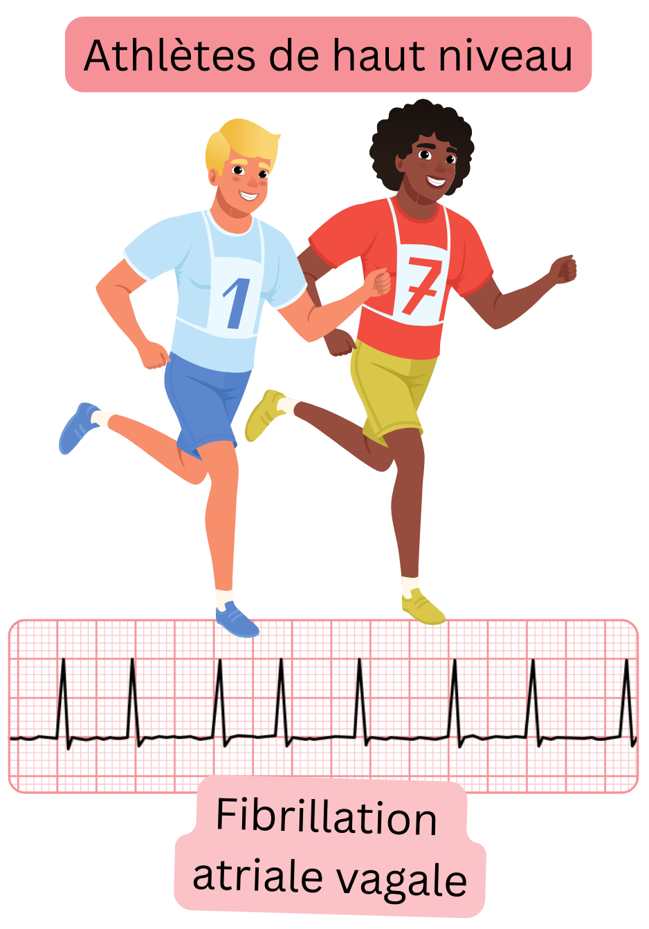 Illustration représentant des sportifs de haut niveau atteints de fibrillation atriale vagale, une forme d’arythmie associée à une augmentation du tonus parasympathique, avec tracé ECG documenté.