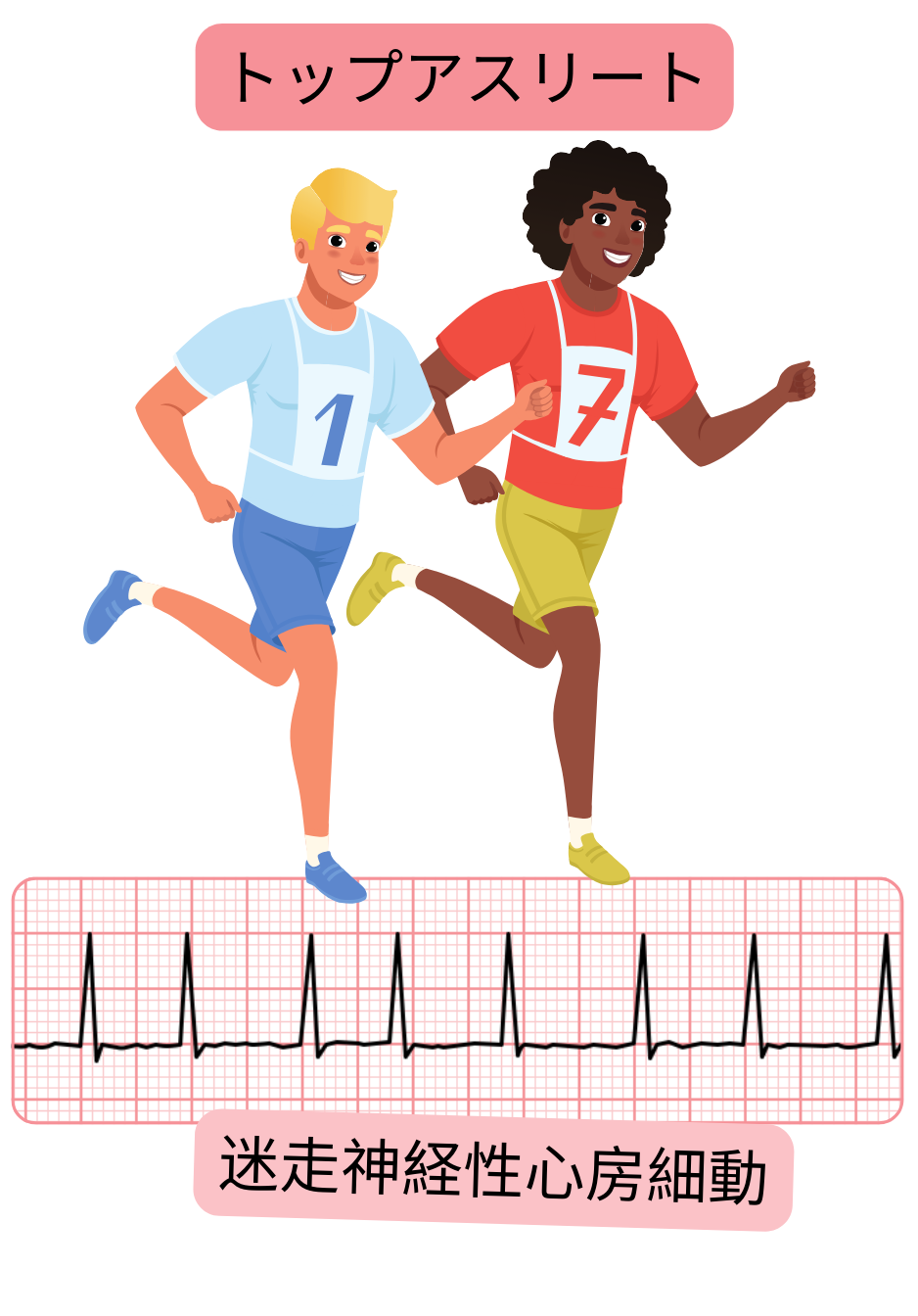 副交感神経緊張の亢進に関連する不整脈として、迷走神経性心房細動を有するトップアスリートを示し、心電図記録を含む図。