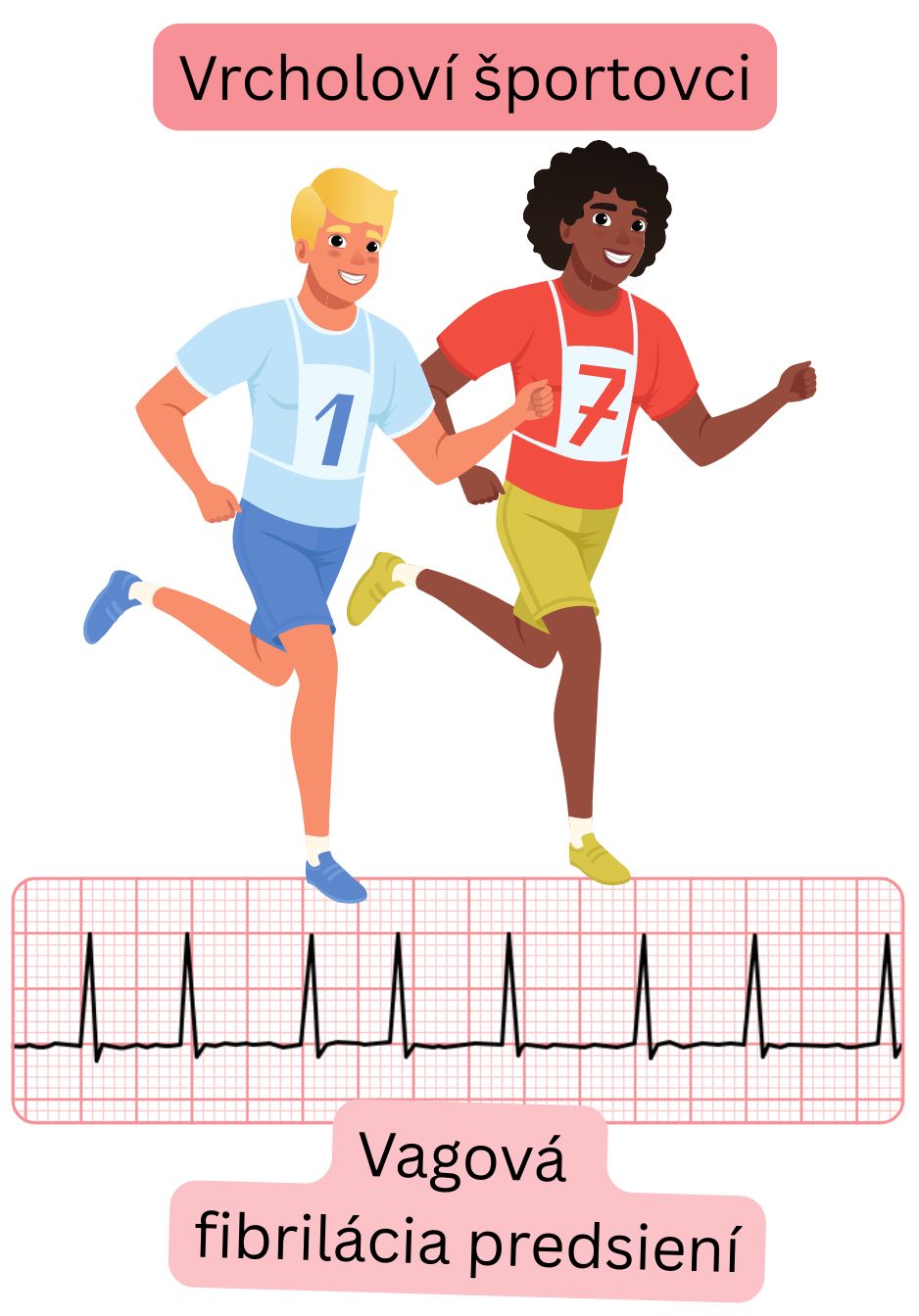 Ilustrácia znázorňujúca vrcholových športovcov s vagovou fibriláciou predsiení ako formou arytmie asociovanej so zvýšeným parasympatikovým tonusom a dokumentovaným EKG záznamom.