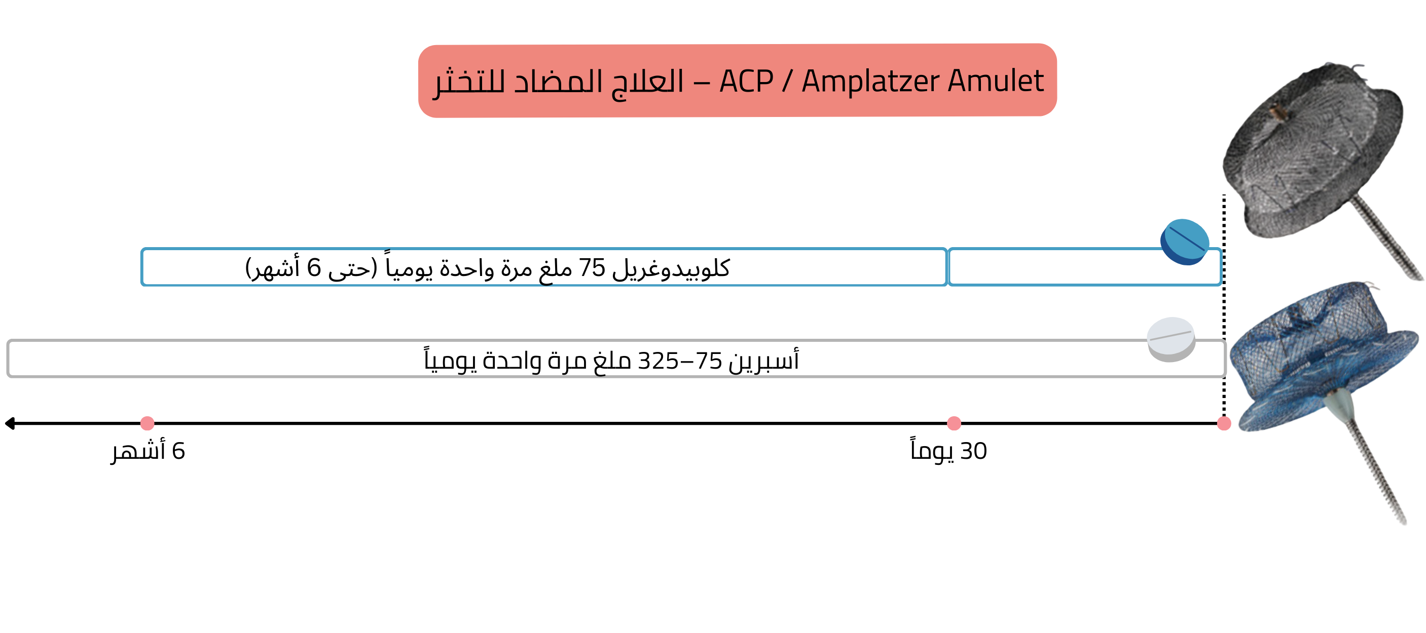 مخطط يوضح العلاج المضاد للتخثر بعد زرع جهازي ACP وAmplatzer Amulet مع إعطاء الكلوبيدوغريل والأسبرين ضمن فترة زمنية محددة تصل إلى 6 أشهر.