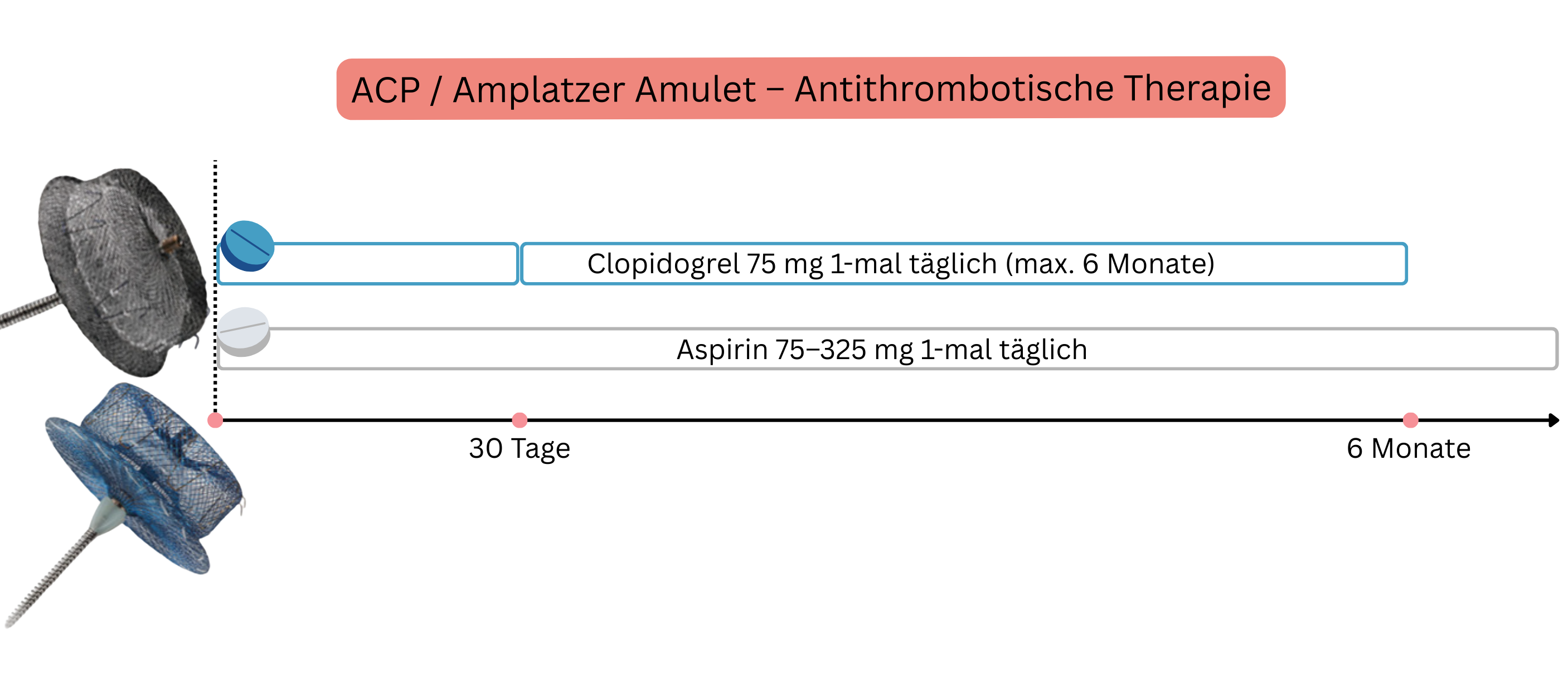 Schema zur Darstellung der antithrombotischen Therapie nach Implantation der Systeme ACP und Amplatzer Amulet mit Gabe von Clopidogrel und Aspirin über einen definierten Zeitraum von bis zu 6 Monaten.